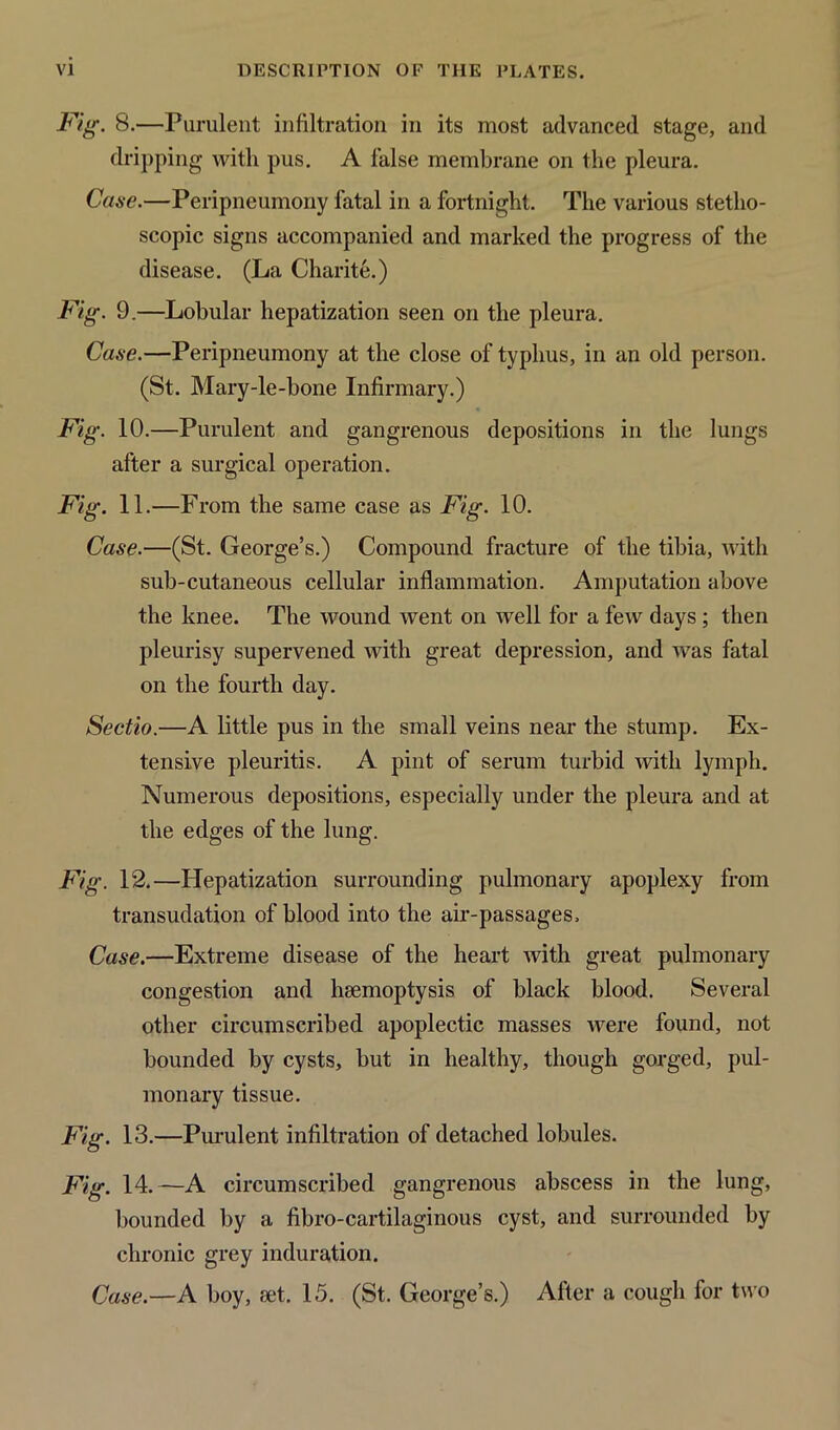 Fig. 8.—Purulent infiltration in its most advanced stage, and dripping with pus. A false membrane on the pleura. Case.—Peripneumony fatal in a fortnight. The various stetho- scopic signs accompanied and marked the progress of the disease. (La Charite.) Fig. 9.—Lobular hepatization seen on the pleura. Case.—Peripneumony at the close of typhus, in an old person. (St. Mary-le-bone Infirmary.) Fig. 10.—Purulent and gangrenous depositions in the lungs after a surgical operation. Fig. 11.—From the same case as Fig. 10. Case.—(St. George’s.) Compound fracture of the tibia, with sub-cutaneous cellular inflammation. Amputation above the knee. The wound went on well for a few days ; then pleurisy supervened with great depression, and was fatal on the fourth day. Sectio.—A little pus in the small veins near the stump. Ex- tensive pleuritis. A pint of serum turbid with lymph. Numerous depositions, especially under the pleura and at the edges of the lung. Fig. 12.—Hepatization surrounding pulmonary apoplexy from transudation of blood into the air-passages. Case.—Extreme disease of the heart with great pulmonary congestion and haemoptysis of black blood. Several other circumscribed apoplectic masses were found, not bounded by cysts, but in healthy, though gorged, pul- monary tissue. Fig. 13.—Purulent infiltration of detached lobules. Fig. 14.—A circumscribed gangrenous abscess in the lung, bounded by a fibro-cartilaginous cyst, and surrounded by chronic grey induration. Case.—A boy, set. 15. (St. George’s.) After a cough for two