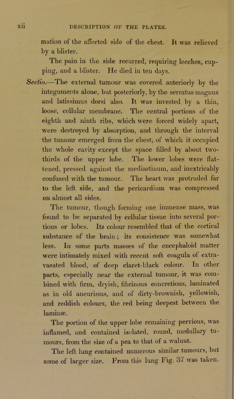 mation of the affected side of the chest. It was relieved by a blister. The pain in the side recurred, requiring leeches, cup- ping, and a blister. He died in ten days. Sectio.—The external tumour was covered anteriorly by the integuments alone, but posteriorly, by the serratus magnus and latissimus dorsi also. It was invested by a thin, loose, cellular membrane. The central portions of the eighth and ninth ribs, which were forced widely apart, were destroyed by absorption, and through the interval the tumour emerged from the chest, of which it occupied the whole cavity except the space filled by about two- thirds of the upper lobe. The lower lobes were flat- tened, pressed against the mediastinum, and inextricably confused with the tumour. The heart was protruded far to the left side, and the pericardium wras compressed on almost all sides. The tumour, though forming one immense mass, was found to be separated by cellular tissue into several por- tions or lobes. Its colour resembled that of the cortical substance of the brain; its consistence was somewhat less. In some parts masses of the encephaloid matter were intimately mixed with recent soft coagula of extra- vasated blood, of deep claret-black colour. In other parts, especially near the external tumour, it was com- bined with firm, dryish, fibrinous concretions, laminated as in old aneurisms, and of dirty-brownish, yellowish, and reddish colours, the red being deepest between the laminm. The portion of the upper lobe remaining pervious, was inflamed, and contained isolated, round, medullary tu- mours, from the size of a pea to that of a walnut. The left lung contained numerous similar tumours, but some of larger size. From this lung Fig. 37 was taken.