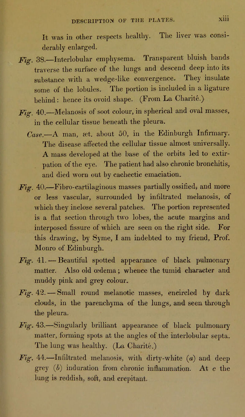 It was in other respects healthy. The liver was consi- derably enlarged. Fig. 3S.—Interlobular emphysema. Transparent bluish bands traverse the surface of the lungs and descend deep into its substance with a wedge-like convergence. They insulate some of the lobules. The portion is included in a ligature behind: hence its ovoid shape. (From La Charite.) Fig. 40.—Melanosis of soot colour, in spherical and oval masses, in the cellular tissue beneath the pleura. Case.—A man, set. about 50, in the Edinburgh Infirmary. The disease affected the cellular tissue almost universally. A mass developed at the base of the orbits led to extir- pation of the eye. The patient had also chronic bronchitis, and died worn out by cachectic emaciation. Fig. 40.—Fibro-cartilaginous masses partially ossified, and more or less vascular, surrounded by infiltrated melanosis, of which they inclose several patches. The portion represented is a flat section through two lobes, the acute margins and interposed fissure of which are seen on the right side. For this drawing, by Syme, I am indebted to my friend, Prof. Monro of Edinburgh. Fig. 41. — Beautiful spotted appearance of black pulmonary matter. Also old oedema; whence the tumid character and muddy pink and grey colour. Fig. 42. — Small round melanotic masses, encircled by dark clouds, in the parenchyma of the lungs, and seen through the pleura. Fig. 43.—Singularly brilliant appearance of black pulmonary matter, forming spots at the angles of the interlobular septa. The lung was healthy. (La Charite.) Fig. 44.—Infiltrated melanosis, with dirty-white (a) and deep grey (6) induration from chronic inflammation. At c the lung is reddish, soft, and crepitant.