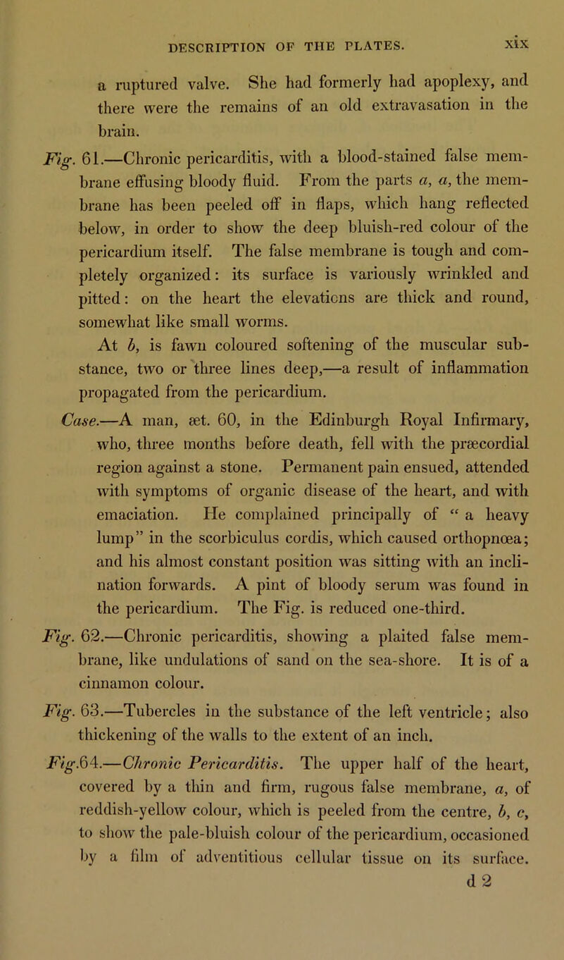 a ruptured valve. She had formerly had apoplexy, and there were the remains of an old extravasation in the brain. Fig. 61.—Chronic pericarditis, with a blood-stained false mem- brane effusing bloody fluid. From the parts a, a, the mem- brane has been peeled off in flaps, which hang reflected below, in order to show the deep bluisli-red colour of the pericardium itself. The false membrane is tough and com- pletely organized: its surface is variously wrinkled and pitted: on the heart the elevations are thick and round, somewhat like small worms. At b, is faAvn coloured softening of the muscular sub- stance, two or three lines deep,—a result of inflammation propagated from the pericardium. Case.—A man, set. 60, in the Edinburgh Royal Infirmary, who, three months before death, fell with the prsecordial region against a stone. Permanent pain ensued, attended with symptoms of organic disease of the heart, and with emaciation. He complained principally of “ a heavy lump” in the scorbiculus cordis, which caused orthopnoea; and his almost constant position was sitting with an incli- nation forwards. A pint of bloody serum was found in the pericardium. The Fig. is reduced one-third. Fig. 62.—Chronic pericarditis, showdng a plaited false mem- brane, like undulations of sand on the sea-shore. It is of a cinnamon colour. Fig. 63.—Tubercles in the substance of the left ventricle; also thickening of the walls to the extent of an inch. Fig.64.—Chronic Pericarditis. The upper half of the heart, covered by a thin and firm, rugous false membrane, a, of reddish-yellow colour, which is peeled from the centre, b, c, to show the pale-bluish colour of the pericardium, occasioned by a film ol adventitious cellular tissue on its surface. d 2