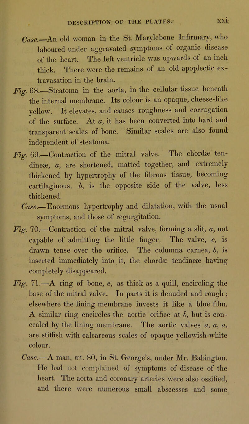 Case.—An old woman in the St. Marylebone Infirmary, who laboured under aggravated symptoms ot organic disease of the heart. The left ventricle was upwards of an inch thick. There were the remains of an old apoplectic ex- travasation in the brain. Fie. 68.—Steatoma in the aorta, in the cellular tissue beneath the internal membrane. Its colour is an opaque, cheese-like yellow. It elevates, and causes roughness and corrugation of the surface. At a, it has been converted into hard and transparent scales of bone. Similar scales are also found independent of steatoma. Fig. 69.—Contraction of the mitral valve. The chordae ten- dineae, a, are shortened, matted together, and extremely thickened by hypertrophy of the fibrous tissue, becoming cartilaginous, b, is the opposite side of the valve, less thickened. Case.—Enormous hypertrophy and dilatation, with the usual symptoms, and those of regurgitation. Fig. 70.—Contraction of the mitral valve, forming a slit, a, not capable of admitting the little finger. The valve, c, is drawn tense over the orifice. The columna carnea, b, is inserted immediately into it, the chordae tendineae having completely disappeared. Fig. 71.—A ring of bone, c, as thick as a quill, encircling the base of the mitral valve. In parts it is denuded and rough; elsewhere the lining membrane invests it like a blue film. A similar ring encircles the aortic orifice at b, but is con- cealed by the lining membrane. The aortic valves a, a, a, are stiffish with calcareous scales of opaque yellowish-white colour. Case.—A man, ?et. 80, in St. George’s, under Mr. Babington. He had not complained of symptoms of disease of the heart. The aorta and coronary arteries were also ossified, and there were numerous small abscesses and some