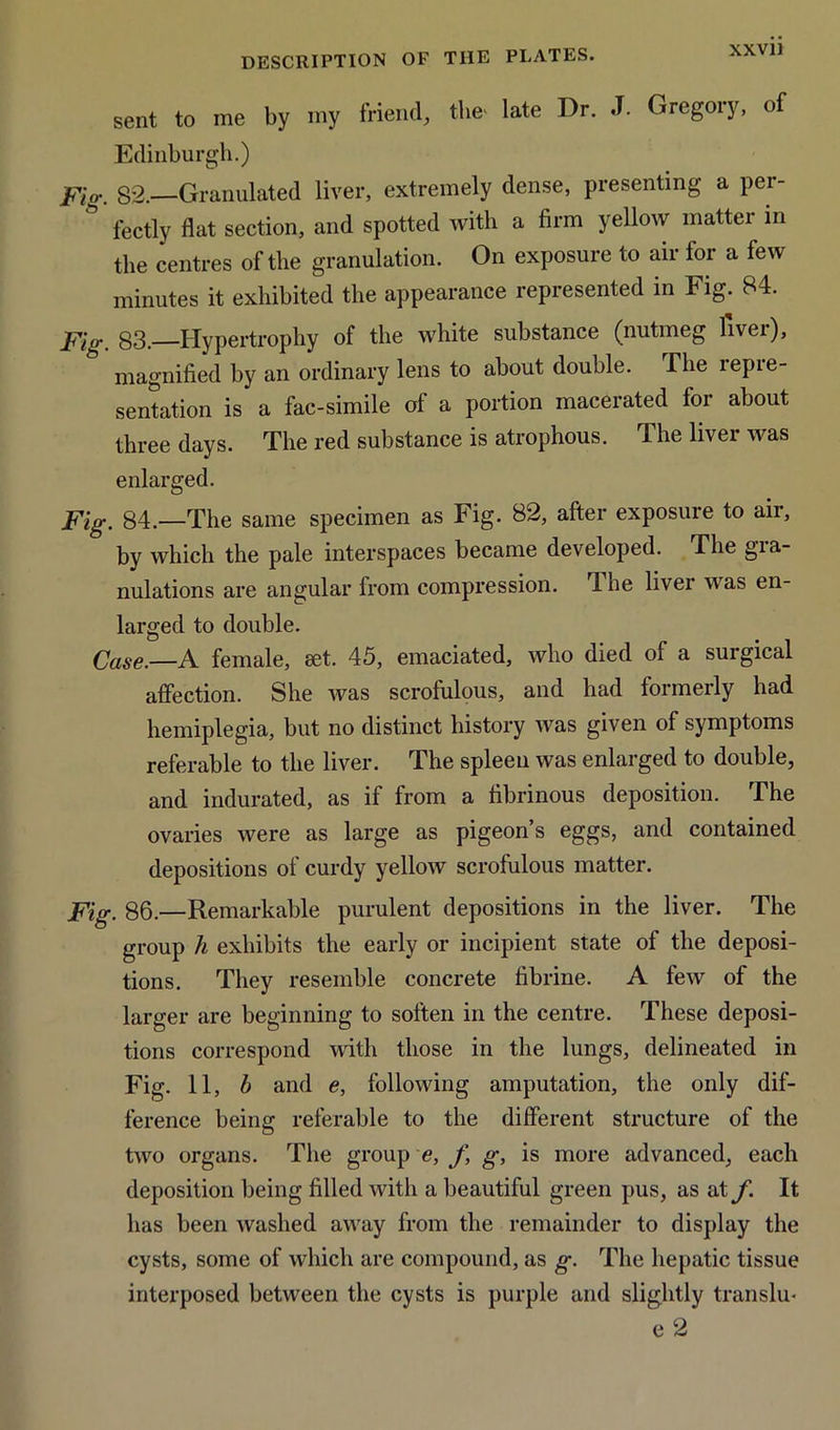 XXV1J sent to me by my friend, the* late Dr. J. Gregory, of Edinburgh.) Fig. 82.—Granulated liver, extremely dense, presenting a per- fectly flat section, and spotted with a firm yellow matter in the centres of the granulation. On exposure to air for a few minutes it exhibited the appearance represented in Fig. 84. Fig. 83.—Hypertrophy of the white substance (nutmeg liver), magnified by an ordinary lens to about double. The repre- sentation is a fac-simile of a portion macerated for about three days. The red substance is atrophous. The liver was enlarged. Fig. 84.—The same specimen as Fig. 82, after exposure to air, by which the pale interspaces became developed. The gia- nulations are angular from compression. 4 he liver was en- larged to double. Case.—A female, set. 45, emaciated, who died of a surgical affection. She was scrofulous, and had formerly had hemiplegia, but no distinct history was given of symptoms referable to the liver. The spleen was enlarged to double, and indurated, as if from a fibrinous deposition. The ovaries were as large as pigeon’s eggs, and contained depositions ol curdy yellow scrofulous matter. Fig. 86.—Remarkable purulent depositions in the liver. The group h exhibits the early or incipient state of the deposi- tions. They resemble concrete fibrine. A tew of the larger are beginning to soften in the centre. These deposi- tions correspond with those in the lungs, delineated in Fig. 11, b and e, following amputation, the only dif- ference being referable to the different structure of the two organs. The group e, f, g, is more advanced, each deposition being filled with a beautiful green pus, as at f. It has been washed away from the remainder to display the cysts, some of which are compound, as g. The hepatic tissue interposed between the cysts is purple and slightly translu* e 2