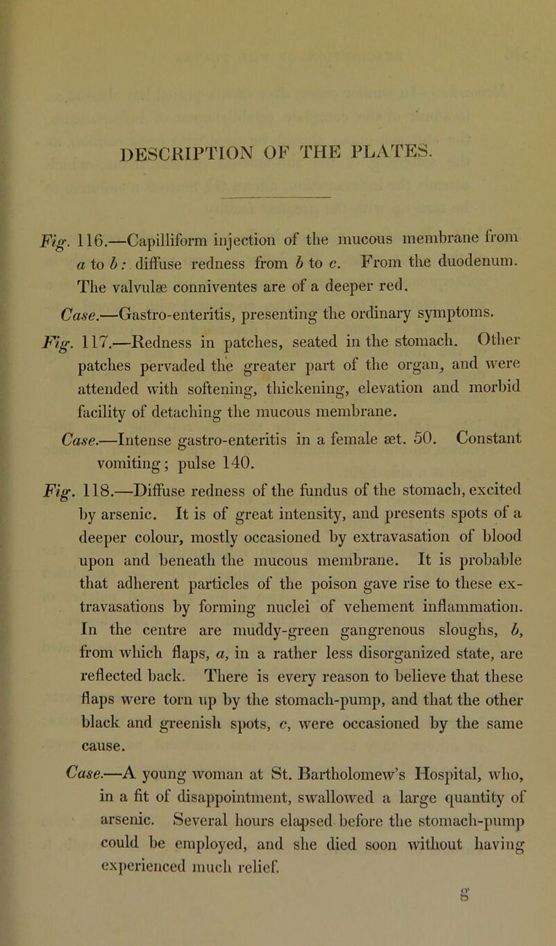 Fig. 116.—Capilliform injection of the mucous membrane from a to b: diffuse redness from b to c. From the duodenum. The valvulse conniventes are of a deeper red. Case.—Gastro-enteritis, presenting the ordinary symptoms. Fig. 117.—Redness in patches, seated in the stomach. Other patches pervaded the greater part of the organ, and were attended with softening, thickening, elevation and morbid facility of detaching the mucous membrane. Case.—Intense gastro-enteritis in a female set. 50. Constant vomiting; pulse 140. Fig. 118.—Diffuse redness of the fundus of the stomach, excited by arsenic. It is of great intensity, and presents spots of a deeper colour, mostly occasioned by extravasation of blood upon and beneath the mucous membrane. It is probable that adherent particles of the poison gave rise to these ex- travasations by forming nuclei of vehement inflammation. In the centre are muddy-green gangrenous sloughs, b, from which flaps, a, in a rather less disorganized state, are reflected back. There is every reason to believe that these flaps were torn up by the stomach-pump, and that the other black and greenish spots, c, were occasioned by the same cause. Case.—A young woman at St. Bartholomew’s Hospital, who, in a fit of disappointment, swallowed a large quantity of arsenic. Several hours elapsed before the stomach-pump could be employed, and she died soon without having experienced much relief.