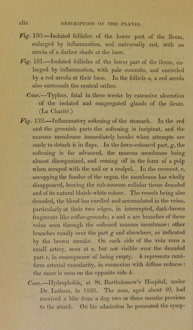 Fig\ 130.—Isolated follicles of the lower part of the ileum, enlarged by inflammation, and universally red, with an areola of a darker shade at the base. Fig. 131.—Isolated follicles of the lower part of the ileum, en- larged by inflammation, with pale summits, and encircled by a red areola at their base. In the follicle a, a red areola also surrounds the central orifice. Case.—Typhus, fatal in three weeks by extensive ulceration of the isolated and congregated glands of the ileum. (La Charite.) Fig. 132.—Inflammatory softening of the stomach. In the red and the greenish parts the softening is incipient, and the mucous membrane immediately breaks when attempts are made to detach it in flaps. In the fawn-coloured part, g, the softening is far advanced, the mucous membrane being almost disorganized, and coming off in the form of a pulp when scraped with the nail or a scalpel. In the crescent, c, occupying the fundus of the organ, the membrane has wholly disappeared, leaving the sub-mucous cellular tissue denuded and of its natural bluisli-white colour. The vessels being also denuded, the blood has curdled and accumulated in the veins, particularly at their two edges, in interrupted, dark-brown fragments like coffee-grounds; e and a are branches of these veins seen through the softened mucous membrane: other branches ramify over the part g and elsewhere, as indicated by the brown streaks. On each side of the vein runs a small artery, seen at e, but not visible over the denuded part c, in consecpience of being empty, h represents rami- form arterial vascularity, in connexion with difluse redness: the same is seen on the opposite side b. Case.—Hydrophobia, at St. Bartholomew’s Hospital, under Dr. Latham, in 1826. The man, aged about 40, had received a bite from a dog two or three months previous to the attack. On his admission he presented the symp-