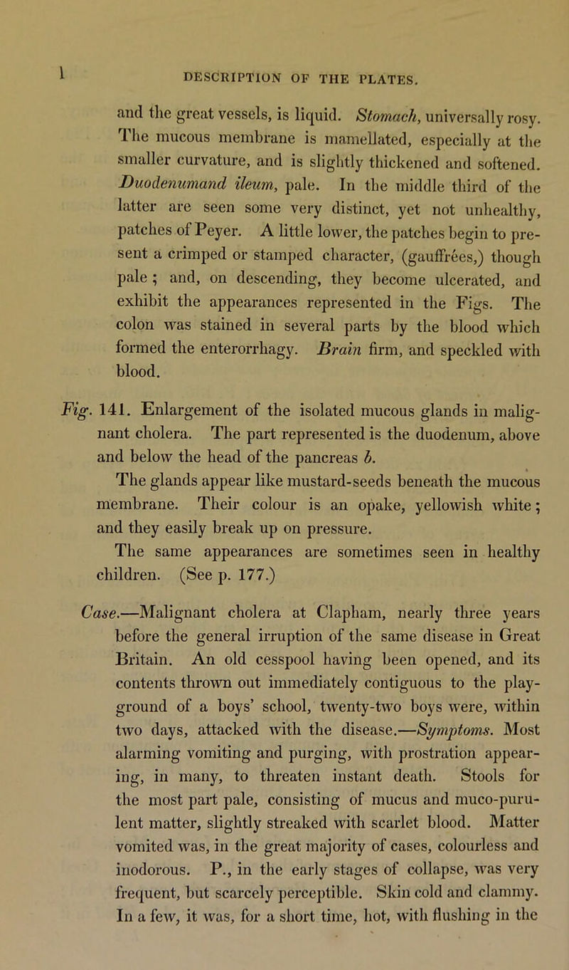 1 and the great vessels, is liquid. Stomach, universally rosy. The mucous membrane is mamellated, especially at the smaller curvature, and is slightly thickened and softened. Duodenumand ileum, pale. In the middle third of the latter are seen some very distinct, yet not unhealthy, patches of Peyer. A little lower, the patches begin to pre- sent a crimped or stamped character, (gaufffees,) though pale ; and, on descending, they become ulcerated, and exhibit the appearances represented in the Figs. The colon was stained in several parts by the blood which formed the enterorrhagy. Brain firm, and speckled with blood. Fig. 141. Enlargement of the isolated mucous glands in malig- nant cholera. The part represented is the duodenum, above and below the head of the pancreas h. The glands appear like mustard-seeds beneath the mucous membrane. Their colour is an opake, yellowish white; and they easily break up on pressure. The same appearances are sometimes seen in healthy children. (See p. 177.) Case.—Malignant cholera at Clapham, nearly three years before the general irruption of the same disease in Great Britain. An old cesspool having been opened, and its contents thrown out immediately contiguous to the play- ground of a boys’ school, twenty-two boys were, within two days, attacked with the disease.—Symptoms. Most alarming vomiting and purging, with prostration appear- ing, in many, to threaten instant death. Stools for the most part pale, consisting of mucus and muco-puru- lent matter, slightly streaked with scarlet blood. Matter vomited was, in the great majority of cases, colourless and inodorous. P., in the early stages of collapse, was very frequent, but scarcely perceptible. Skin cold and clammy. In a few, it was, for a short time, hot, with flushing in the
