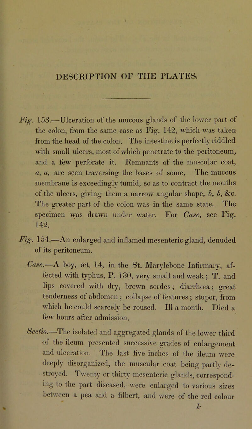 Fig. 153.—Ulceration of the mucous glands of the lower part of the colon, from the same case as Fig. 142, which was taken from the head of the colon. The intestine is perfectly riddled with small ulcers, most of which penetrate to the peritoneum, and a few perforate it. Remnants of the muscular coat, a, a, are seen traversing the bases of some. The mucous membrane is exceedingly tumid, so as to contract the mouths of the ulcers, giving them a narrow angular shape, b, b, &c. The greater part of the colon was in the same state. The specimen was drawn under water. For Case, see Fig. 142. Fig. 154.—An enlarged and inflamed mesenteric gland, denuded of its peritoneum. Case.—A boy, set. 14, in the St. Marylebone Infirmary, af- fected with typhus, P. 130, very small and weak; T. and lips covered with dry, brown sordes; diarrhoea; great tenderness of abdomen ; collapse of features ; stupor, from which he could scarcely be roused. Ill a month. Died a few hours after admission. Sectio.—The isolated and aggregated glands of the lower third of the ileum presented successive grades of enlargement and ulceration. rlhe last five inches oi the ileum were deeply disorganized, the muscular coat being partly de- stroyed. Twenty or thirty mesenteric glands, correspond- ing to the part diseased, were enlarged to various sizes between a pea and a filbert, and were of the red colour k