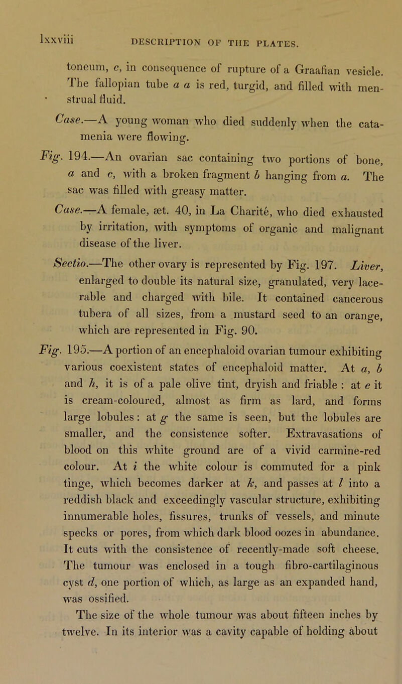 lxxviii toneum, c, in consequence of rupture of a Graafian vesicle. The fallopian tube a a is red, turgid, and filled with men- strual fluid. Case. A young woman who died suddenly when the cata- menia were flowing. Fig. 194.—An ovarian sac containing two portions of bone, a and c, with a broken fragment b hanging from a. The sac was filled with greasy matter. Case.—A female, set. 40, in La Charite, who died exhausted by irritation, with symptoms of organic and malignant disease of the liver. Sectio.—The other ovary is represented by Fig. 197. Liver, enlarged to double its natural size, granulated, very lace- rable and charged with bile. It contained cancerous tubera of all sizes, from a mustard seed to an orange, which are represented in Fig. 90. Fig. 195.—A portion of an encephaloid ovarian tumour exhibiting various coexistent states of encephaloid matter. At a, b and it, it is of a pale olive tint, dryish and friable : at e it is cream-coloured, almost as firm as lard, and forms large lobules: at g the same is seen, but the lobules are smaller, and the consistence softer. Extravasations of blood on this white ground are of a vivid carmine-red colour. At i the white colour is commuted for a pink tinge, which becomes darker at k, and passes at l into a reddish black and exceedingly vascular structure, exhibiting innumerable holes, fissures, trunks of vessels, and minute specks or pores, from which dark blood oozes in abundance. It cuts with the consistence of recently-made soft cheese. The tumour was enclosed in a tough fibro-cartilaginous cyst d, one portion of which, as large as an expanded hand, was ossified. The size of the whole tumour was about fifteen inches by twelve. In its interior was a cavity capable of holding about