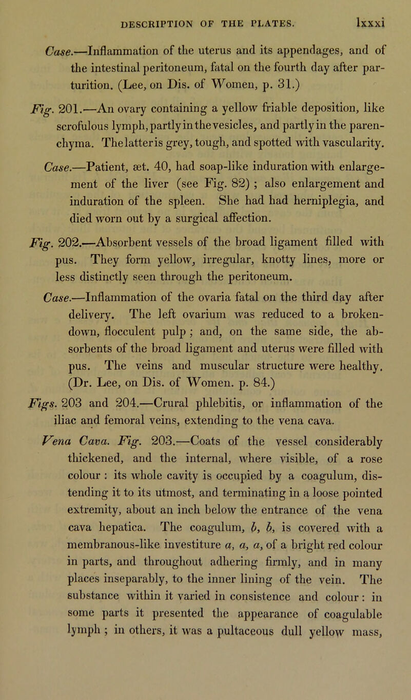 Case.—Inflammation of the uterus and its appendages, and of the intestinal peritoneum, fatal on the fourth day after par- turition. (Lee, on Dis. of Women, p. 31.) Fig. 201.—An ovary containing a yellow friable deposition, like scrofulous lymph, partly in the vesicles, and partly in the paren- chyma. The latter is grey, tough, and spotted with vascularity. Case.—Patient, set. 40, had soap-like induration with enlarge- ment of the liver (see Fig. 82) ; also enlargement and induration of the spleen. She had had hemiplegia, and died worn out by a surgical affection. Fig. 202.—Absorbent vessels of the broad ligament filled with pus. They form yellow, irregular, knotty lines, more or less distinctly seen through the peritoneum. Case.—Inflammation of the ovaria fatal on the third day after delivery. The left ovarium was reduced to a broken- down, flocculent pulp ; and, on the same side, the ab- sorbents of the broad ligament and uterus were filled with pus. The veins and muscular structure were healthy. (Dr. Lee, on Dis. of Women, p. 84.) Figs. 203 and 204.—Crural phlebitis, or inflammation of the iliac and femoral veins, extending to the vena cava. Vena Cava. Fig. 203.—Coats of the vessel considerably thickened, and the internal, where visible, of a rose colour : its whole cavity is occupied by a coagulum, dis- tending it to its utmost, and terminating in a loose pointed extremity, about an inch below the entrance of the vena cava hepatica. The coagulum, b, b, is covered, with a membranous-like investiture a, a, a, of a bright red colour in parts, and throughout adhering firmly, and in many places inseparably, to the inner lining of the vein. The substance within it varied in consistence and colour: in some parts it presented the appearance of coagulable lymph ; in others, it was a pultaceous dull yellow mass,