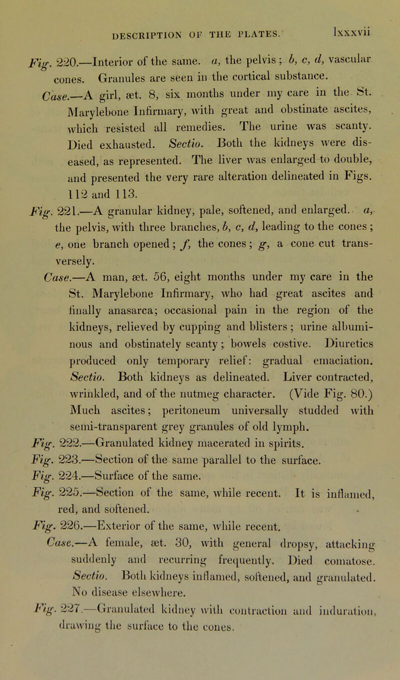 Fig. 220.—Interior of the same, a, the pelvis ; b, c, d, vascular cones. Granules are seen in the cortical substance. Case. A girl, set. 8, six months under my care in the St. Marylebone Infirmary, with great and obstinate ascites, which resisted all remedies. The urine was scanty. Died exhausted. Sectio. Both the kidneys were dis- eased, as represented. The liver was enlarged to double, and presented the very rare alteration delineated in Figs. 112 and 113. Fig. 221.—A granular kidney, pale, softened, and enlarged, a, the pelvis, with three branches, b, c, d, leading to the cones ; e, one branch opened; /, the cones; g, a cone cut trans- versely. Case.—A man, set. 56, eight months under my care in the St. Marylebone Infirmary, who had great ascites and finally anasarca; occasional pain in the region of the kidneys, relieved by cupping and blisters; urine albumi- nous and obstinately scanty; bowels costive. Diuretics produced only temporary relief: gradual emaciation. Sectio. Both kidneys as delineated. Liver contracted, wrinkled, and of the nutmeg character. (Vide Fig. 80.) Much ascites; peritoneum universally studded with semi-transparent grey granules of old lymph. Fig. 222.—Granulated kidney macerated in spirits. Fig. 223.—Section of the same parallel to the surface. Fig. 224.—Surface of the same. Fig. 225.—Section of the same, while recent. It is inflamed, red, and softened. Fig. 226.—Exterior of the same, while recent. Case.—A female, set. 30, with general dropsy, attacking suddenly and recurring frequently. Died comatose. Sectio. Both kidneys inflamed, softened, and granulated. No disease elsewhere. 22<.—Granulated kidney with contraction and drawing the surface to the cones. induration.