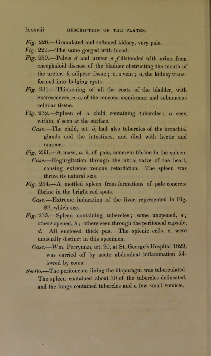 Fig. 228.—Granulated and softened kidney, very pale. Fig. 229.—The same gorged with blood. Fig. 230.—Pelvis d and ureter e f distended with urine, from encephaloid disease of the bladder obstructing the mouth of the ureter, b, adipose tissue ; c, a vein ; a, the kidney trans- formed into bulging cysts. Fig. 231.—Thickening of all the coats of the bladder, with excrescences, c, e, of the mucous membrane, and submucous cellular tissue. Fig. 232.—Spleen of a child containing tubercles ; a seen within, d seen at the surface. Case.—The child, set. 5, had also tubercles of the bronchial glands and the intestines, and died with hectic and marcor. Fig. 233.—A mass, a, b, of pale, concrete fibrine in the spleen. Case.—Regurgitation through the nitral valve of the heart, causing extreme venous retardation. The spleen was thrice its natural size. Fig. 234.—A mottled spleen from formations of pale concrete fibrine in the bright red spots. Case.—Extreme induration of the liver, represented in Fig. 82, which see. Fig. 235.—Spleen containing tubercles ; some unopened, a; others opened, b; others seen through the peritoneal capsule, d. All enclosed thick pus. The splenic cells, c, were unusually distinct in this specimen. Case.—Win. Perryman, set. 20, at St. George’s Hospital 1829, was carried off by acute abdominal inflammation fol- lowed by coma. Sectio.—The peritoneum lining the diaphragm was tuberculated. The spleen contained about 30 of the tubercles delineated, and the lungs contained tubercles and a few small vomicse.