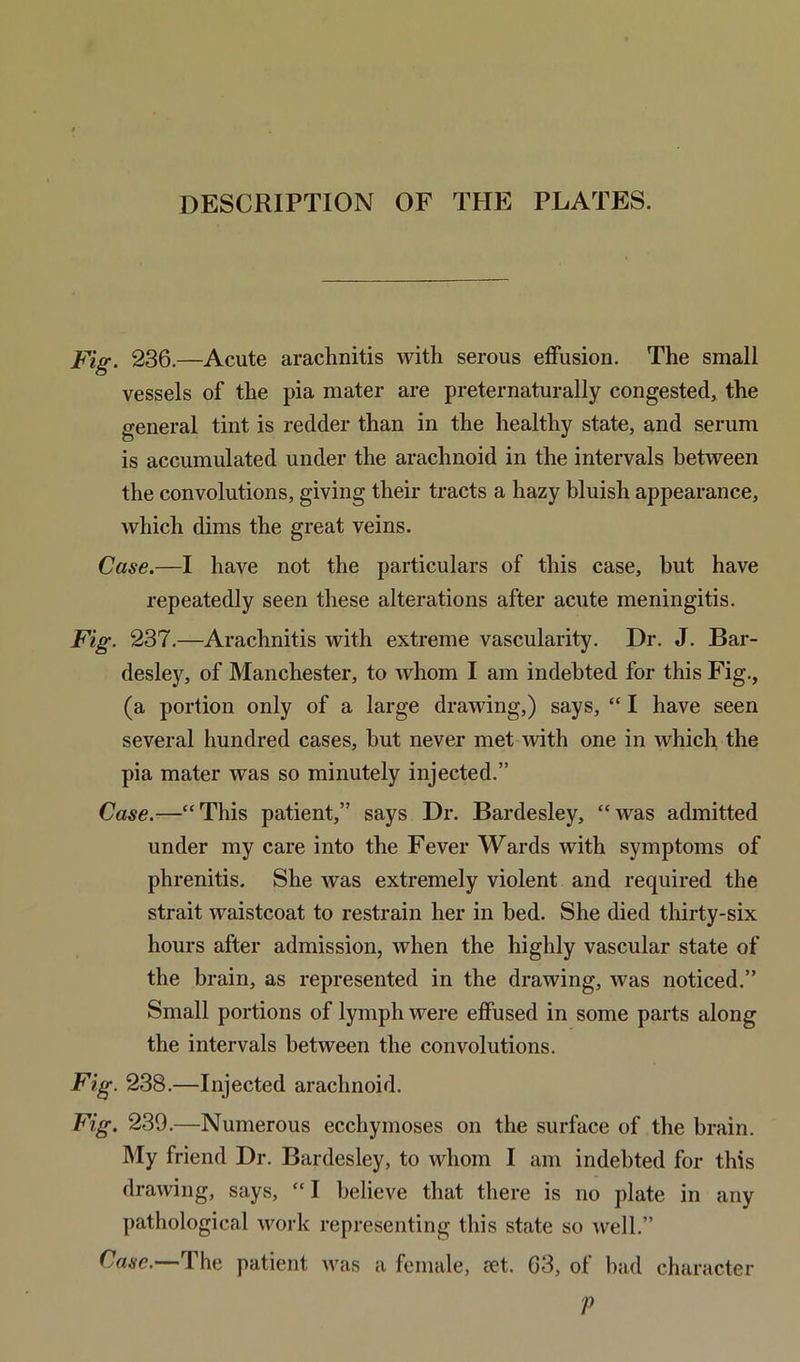 DESCRIPTION OF THE PLATES. Fig. 236.—Acute arachnitis with serous effusion. The small vessels of the pia mater are preternaturally congested, the general tint is redder than in the healthy state, and serum is accumulated under the arachnoid in the intervals between the convolutions, giving their tracts a hazy bluish appearance, which dims the great veins. Case.—I have not the particulars of this case, but have repeatedly seen these alterations after acute meningitis. Fig. 237.—Arachnitis with extreme vascularity. Dr. J. Bar- desley, of Manchester, to whom I am indebted for this Fig., (a portion only of a large drawing,) says, “ I have seen several hundred cases, hut never met with one in which the pia mater was so minutely injected.” Case.—“This patient,” says Dr. Bardesley, “was admitted under my care into the Fever Wards with symptoms of phrenitis. She was extremely violent and required the strait waistcoat to restrain her in bed. She died thirty-six hours after admission, when the highly vascular state of the brain, as represented in the drawing, was noticed.” Small portions of lymph were effused in some parts along the intervals between the convolutions. Fig. 238.—Injected arachnoid. Fig. 239.—Numerous ecchymoses on the surface of the brain. My friend Dr. Bardesley, to whom I am indebted for this drawing, says, “ I believe that there is no plate in any pathological work representing this state so well.” Case.—The patient was a female, set. 63, of bad character P