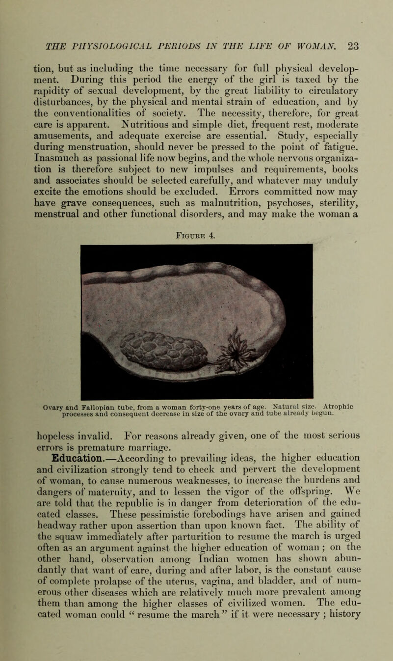 tion, but as including the time necessary for full physical develop- ment. During this period the energy of the girl is taxed by the rapidity of sexual development, by the great liability to circulatory disturbances, by the physical and mental strain of education, and by the conventionalities of society. The necessity, therefore, for great care is apparent. Nutritious and simple diet, frequent rest, moderate amusements, and adequate exercise are essential. Study, especially during menstruation, should never be pressed to the point of fatigue. Inasmuch as passional life now begins, and the whole nervous organiza- tion is therefore subject to new impulses and requirements, books and associates should be selected carefully, and whatever may unduly excite the emotions should be excluded. Errors committed now may have grave consequences, such as malnutrition, psychoses, sterility, menstrual and other functional disorders, and may make the woman a Figure 4. Ovary and Fallopian tube, from a woman forty-one years of age. Natural size. Atrophic processes and consequent decrease in size of the ovary and tube already begun. hopeless invalid. For reasons already given, one of the most serious errors is premature marriage. Education.—According to prevailing ideas, the higher education and civilization strongly tend to check and pervert the development of woman, to cause numerous weaknesses, to increase the burdens and dangers of maternity, and to lessen the vigor of the offspring. We are told that the republic is in danger from deterioration of the edu- cated classes. These pessimistic forebodings have arisen and gained headway rather upon assertion than upon known fact. The ability of the squaw immediately after parturition to resume the march is urged often as an argument against the higher education of woman ; on the other hand, observation among Indian women has shown abun- dantly that want of care, during and after labor, is the constant cause of complete prolapse of the uterus, vagina, and bladder, and of num- erous other diseases which are relatively much more prevalent among them than among the higher classes of civilized women. The edu- cated woman could “ resume the march” if it were necessary ; history