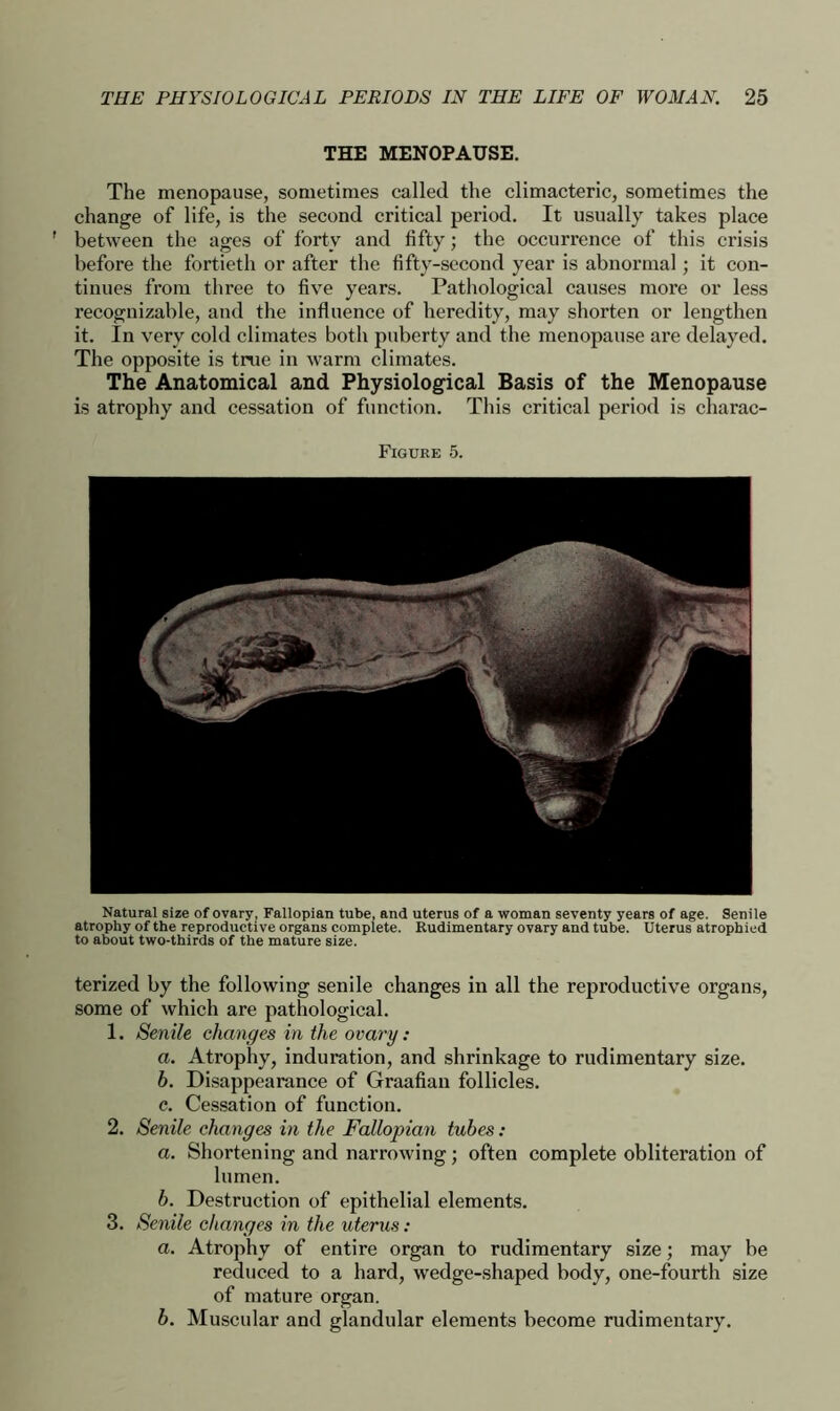 THE MENOPAUSE. The menopause, sometimes called the climacteric, sometimes the change of life, is the second critical period. It usually takes place ' between the ages of forty and fifty; the occurrence of this crisis before the fortieth or after the fifty-second year is abnormal; it con- tinues from three to five years. Pathological causes more or less recognizable, and the influence of heredity, may shorten or lengthen it. In very cold climates both puberty and the menopause are delayed. The opposite is true in warm climates. The Anatomical and Physiological Basis of the Menopause is atrophy and cessation of function. This critical period is charac- Figure 5. Natural size of ovary, Fallopian tube, and uterus of a woman seventy years of age. Senile atrophy of the reproductive organs complete. Rudimentary ovary and tube. Uterus atrophied to about two-thirds of the mature size. terized by the following senile changes in all the reproductive organs, some of which are pathological. 1. Senile changes in the ovary: a. Atrophy, induration, and shrinkage to rudimentary size. b. Disappearance of Graafian follicles. c. Cessation of function. 2. Senile changes in the Fallopian tubes : a. Shortening and narrowing; often complete obliteration of lumen. b. Destruction of epithelial elements. 3. Senile changes in the uterus: a. Atrophy of entire organ to rudimentary size; may be reduced to a hard, wedge-shaped body, one-fourth size of mature organ. b. Muscular and glandular elements become rudimentary.
