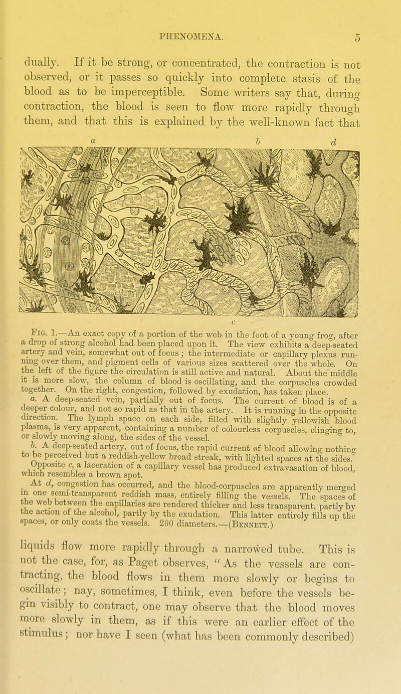 dually. If it be strong, or concentrated, the contraction is not observed, or it passes so quickly into complete stasis of the blood as to be imperceptible. Some miters say that, during contraction, the blood is seen to flow more rapidly through them, and that this is explained by the well-known fact that Fig. 1.—An exact copy of a portion of the web in the foot of a young frog, after a drop of strong alcohol had been placed \vpon it. The view exhibits a deep-seated artery and vein, somewhat out of focus ; the intei-mediate or capillary plexus run- ning over them, and pigment cells of various sizes scattered over the whole. On the left of the figure the circulation is still active and natural. About the middle it is more slow, the column of blood is oscillating, and the corpuscles crowded together. On the right, congestion, followed by exudation, has taken place. a. A deep-seated vein, partially out of focus. The current of blood is of a deeper colour, and not so rapid as that in the artery. It is running in the opposite direction. The lymph space on each side, fiUed with slightly yellowish blood plasma, is very apparent, containing a number of colourless corpuscles, clingino- to or slowly moving along, the sides of the vessel.  ' h A deep-seated artery, out of focus, the rapid current of blood allowing nothino- to be perceived but a reddish-yellow broad streak, with lighted spaces at the sides.'' Opposite c, a laceration of a capillary vessel has produced extravasation of blood, which resembles a brown spot. _ At d, congestion has occurred, and the blood-corpuscles are apparently merged m one semi-transparent reddish mass, entirely filUng the vessels. The spaces of tne web between the capillaries are rendered thicker and less transparent, partly by the action of the alcohol, partly by the exudation. This latter entirely fills up the spaces, or only coats the vessels. 200 diameters.—(Bennett.) liquids flow more rapidly through a narrowed tube. This is not the case, for, as Paget obsei-ves,  As the vessels are con- tracting, the blood flows in them more slowly or begins to oscillate; nay, sometimes, I think, even before the vessels be- gin visibly to contract, one may observe that the blood moves more slowly in them, as if this were an earlier effect of the stimulus; nor have I seen (what has been commonly described)