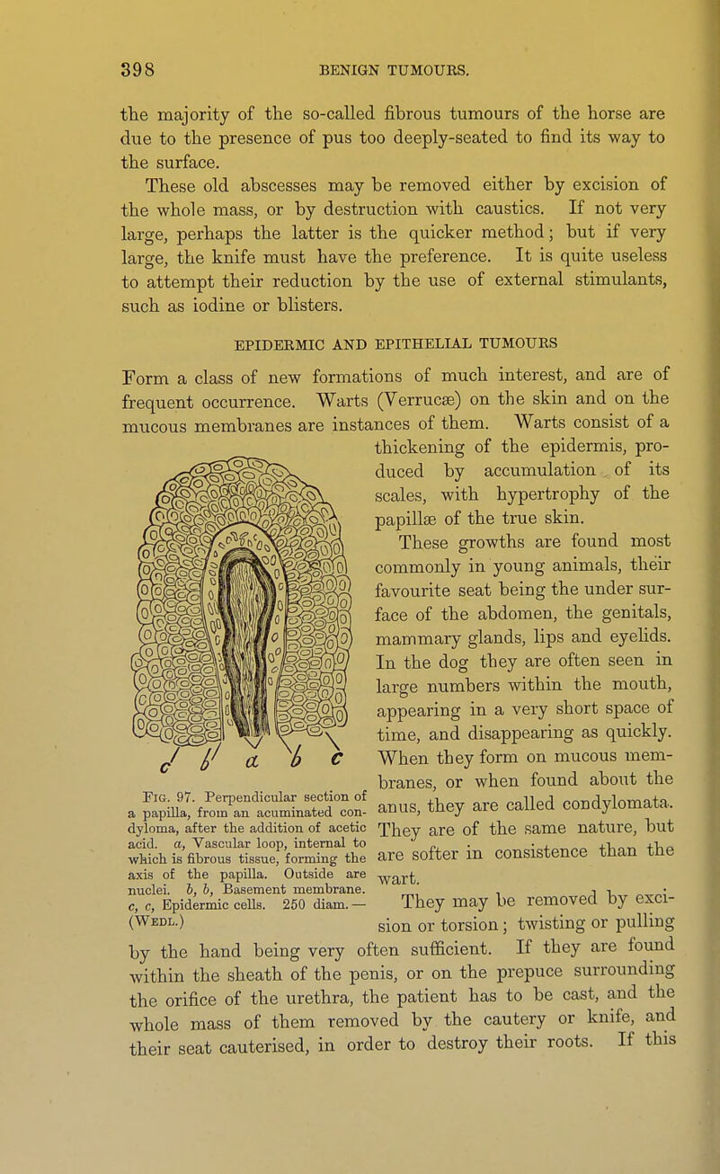 the majority of the so-called fibrous tumours of the horse are due to the presence of pus too deeply-seated to find its way to the surface. These old abscesses may be removed either by excision of the whole mass, or by destruction with caustics. If not very large, perhaps the latter is the quicker method; but if very large, the knife must have the preference. It is quite useless to attempt their reduction by the use of external stimulants, such as iodine or blisters. EPIDERMIC AND EPITHELIAL TUMOURS Form a class of new formations of much interest, and are of frequent occurrence. Warts (Verrucse) on the skin and on the mucous membranes are instances of them. Warts consist of a thickening of the epidermis, pro- duced by accu.mulation of its scales, with hypertrophy of the papillse of the true skin. These growths are found most commonly in young animals, their favourite seat being the under sur- face of the abdomen, the genitals, mammary glands, lips and eyelids. In the dog they are often seen in large numbers within the mouth, appearing in a very short space of time, and disappearing as quickly. When they form on mucous mem- branes, or when found about the a ^:f^:f^^r^:!. anus, they are called condylomata, dyloma, after the addition of acetic They are of the same nature, but acid, a, Vascular loop, internal to n, • • j. „^ +l,r.-r. +1iq which is fibrous tissue^ forming the are softcr lu consistenco than the axis of the papilla. Outside are -^ygj^^ nuclei, h, b, Basement membrane. ' , j i c, c, Epidermic ceUs. 250 diam.- They may be removed by exci- (Wedl.) g^Q^ oj- torsion; twisting or pulling by the hand being very often sufficient. If they are found within the sheath of the penis, or on the prepuce surrounding the orifice of the urethra, the patient has to be cast, and the whole mass of them removed by the cautery or knife, and their seat cauterised, in order to destroy their roots. If this