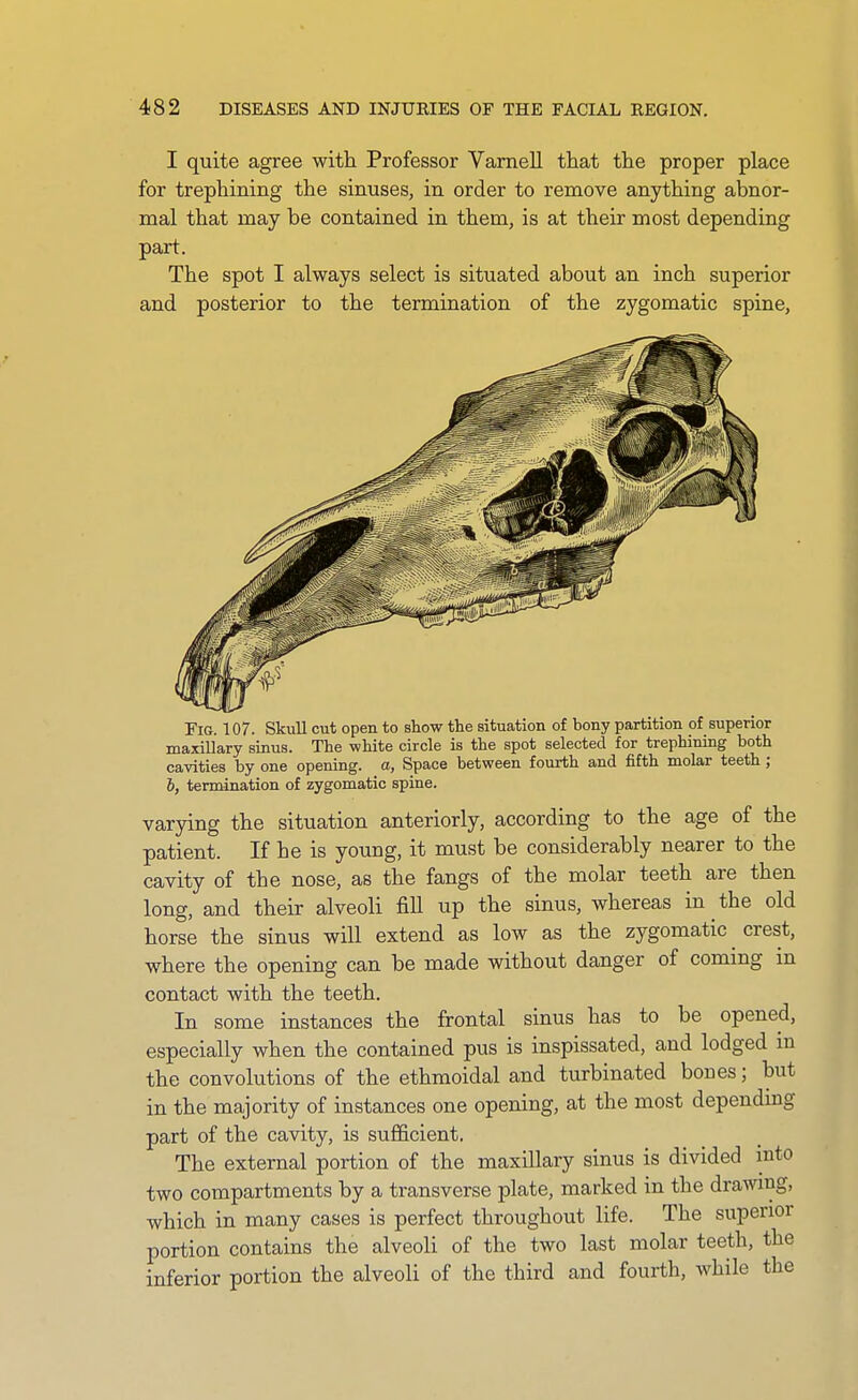 I quite agree with Professor Vamell that the proper place for trephining the sinuses, in order to remove anything abnor- mal that may be contained in them, is at their most depending part. The spot I always select is situated about an inch superior and posterior to the termination of the zygomatic spine. Fig. 107. Skull cut open to show the situation of bony partition of superior maxillary sinus. The white circle is the spot selected for trephining both cavities by one opening, a, Space between fourth and fifth molar teeth ; 6, termination of zygomatic spine. varying the situation anteriorly, according to the age of the patient. If he is young, it must be considerably nearer to the cavity of the nose, as the fangs of the molar teeth are then long, and their alveoli fill up the sinus, whereas in the old horse the sinus will extend as low as the zygomatic crest, where the opening can be made without danger of coming m contact with the teeth. In some instances the frontal sinus has to be opened, especially when the contained pus is inspissated, and lodged m the convolutions of the ethmoidal and turbinated bones; but in the majority of instances one opening, at the most depending part of the cavity, is sufficient. The external portion of the maxillary sinus is divided into two compartments by a transverse plate, marked in the drawing, which in many cases is perfect throughout life. The superior portion contains the alveoli of the two last molar teeth, the inferior portion the alveoli of the third and fourth, while the