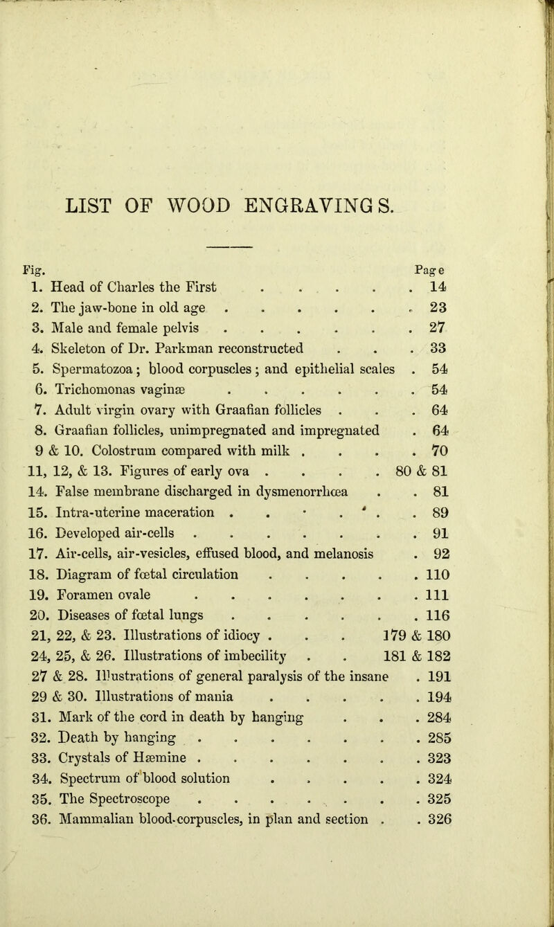 LIST OF WOOD ENGRAVINGS. Fig. Page 1. Head of Charles the First . .... 14 2. The jaw-bone in old age .23 3. Male and female pelvis ...... 27 4. Skeleton of Dr. Parkman reconstructed . . .33 5. Spermatozoa; blood corpuscles ; and epithelial scales . 54 6. Trichomonas vaginae ...... 54 7. Adult virgin ovary with Graafian follicles . . .64 8. Graafian follicles, unimpregnated and impregnated . 64 9 & 10. Colostrum compared with milk . . . .70 11, 12, & 13. Figures of early ova . . . . 80 & 81 14. False membrane discharged in dysmenorrhcea . . 81 15. Intra-uterine maceration . . • * . .89 16. Developed air-cells . . . . . . . 91 17. Air-cells, air-vesicles, effused blood, and melanosis . 92 18. Diagram of foetal circulation . . . . .110 19. Foramen ovale . . . . . . .111 20. Diseases of foetal lungs 116 21. 22, & 23. Illustrations of idiocy . . . 379 & 180 24, 25, & 26. Illustrations of imbecility . . 181 & 182 27 & 28. Illustrations of general paralysis of the insane . 191 29 & 30. Illustrations of mania 194 31. Mark of the cord in death by hanging . . . 284 32. Death by hanging 285 33. Crystals of Hsemine 323 34. Spectrum of blood solution ..... 324 35. The Spectroscope . . . . . . 325 36. Mammalian blood-corpuscles, in plan and section . . 326