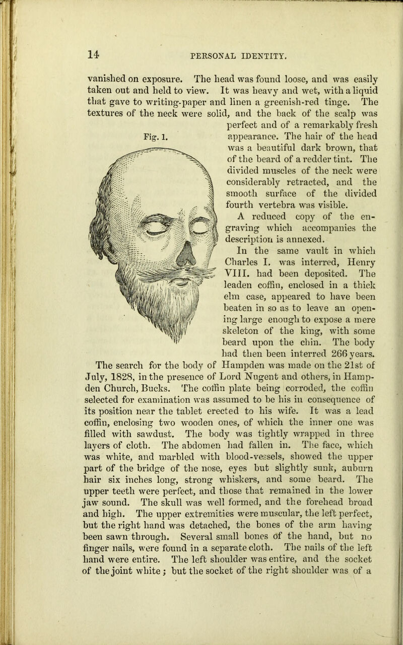 vanished on exposure. The head was found loose, and was easily- taken out and held to view. It was heavy and wet, with a liquid that gave to writing-paper and linen a greenish-red tinge. The textures of the neck were solid, and the back of the scalp was perfect and of a remarkably fresh Fig. l. appearance. The hair of the head was a beautiful dark brown, that of the beard of a redder tint. The divided muscles of the neck were considerably retracted, and the smooth surface of the divided fourth vertebra was visible. A reduced copy of the en- graving which accompanies the description is annexed. In the same vault in which Charles I, was interred, Henry VIII. had been deposited. The leaden coffin, enclosed in a thick elm case, appeared to have been beaten in so as to leave an open- ing large enough to expose a mere skeleton of the king, with some beard upon the chin. The body had then been interred 266 years. The search for the body of Hampden was made on the 21st of July, 1828, in the presence of Lord Nugent and others, in Hamp- den Church, Bucks. The coffin plate being corroded, the coffin selected for examination was assumed to be his in consequence of its position near the tablet erected to his wife. It was a lead coffin, enclosing two wooden ones, of which the inner one was filled with sawdust. The body was tightly wrapped in three layers of cloth. The abdomen had fallen in. The face, which was white, and marbled with blood-vessels, showed the upper part of the bridge of the nose, eyes but slightly sunk, auburn hair six inches long, strong whiskers, and some beard. The upper teeth were perfect, and those that remained in the lower jaw sound. The skull was well formed, and the forehead broad and high. The upper extremities were muscular, the left perfect, but the right hand was detached, the bones of the arm having been sawn through. Several small bones of the hand, but no finger nails, were found in a separate cloth. The nails of the left hand were entire. The left shoulder was entire, and the socket of the joint white; but the socket of the right shoulder was of a