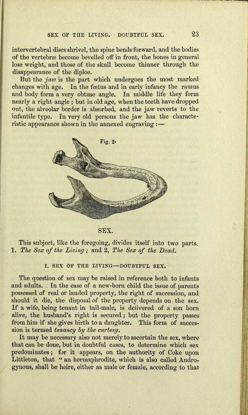 intervertebral discs shrivel, the spine bends forward, and the bodies of the vertebrae become bevelled off in front, the bones in general lose weight, and those of the skull become thinner through the disappearance of the diploe. But the jaw is the part which undergoes the most marked changes with age. In the foetus and in early infancy the ramus and body form a very obtuse angle. In middle life they form nearly a right angle ; but in old age, when the teeth have dropped out, the alveolar border is absorbed, and the jaw reverts to the infantile type. In very old persons the jaw has the characte- ristic appearance shown in the annexed engraving : — SEX. This subject, like the foregoing, divides itself into two parts. 1. The Sex of the Living; and 2, The Sex of the Dead. I. SEX OP THE LIVING—DOUBTFUL SEX. The question of sex may be raised in reference both to infants and adults. In the case of a new-born child the issue of parents possessed of real or landed property, the right of succession, and should it die, the disposal of the property depends on the sex. If a wife, being tenant in tail-male, is delivered of a son born alive, the husband’s right is secured; but the property passes from him if she gives birth to a daughter. This form of succes- sion is termed tenancy by the curtesy. It may be necessary also not merely to ascertain the sex, where that can be done, but in doubtful cases, to determine which sex predominates; for it appears, on the authority of Coke upon Littleton, that “ an hermaphrodite, which is also called Andro- gynous, shall be heire, either as male or female, according to that