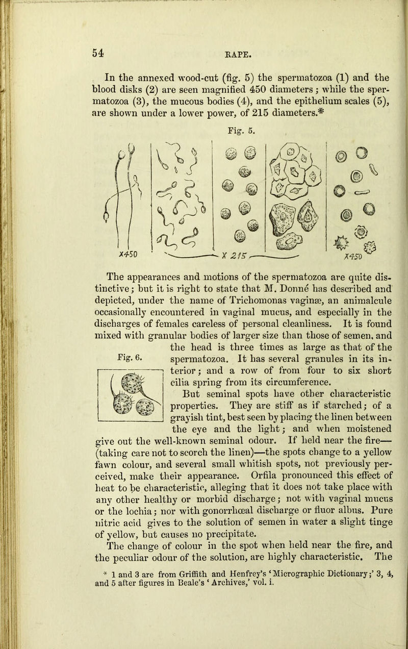 In the annexed wood-cut (fig. 5) the spermatozoa (1) and the blood disks (2) are seen magnified 450 diameters; while the sper- matozoa (3), the mucous bodies (4), and the epithelium scales (5), are shown under a lower power, of 215 diameters.* Fig. 5. - © v m The appearances and motions of the spermatozoa are quite dis- tinctive ; but it is right to state that M. Donne has described and depicted, under the name of Trichomonas vaginae, an animalcule occasionally encountered in vaginal mucus, and especially in the discharges of females careless of personal cleanliness. It is found mixed with granular bodies of larger size than those of semen, and the head is three times as large as that of the spermatozoa. It has several granules in its in- terior; and a row of from four to six short cilia spring from its circumference. But seminal spots have other characteristic properties. They are stiff as if starched; of a grayish tint, best seen by placing the linen between the eye and the light; and when moistened give out the well-known seminal odour. If held near the fire— (taking care not to scorch the linen)—the spots change to a yellow fawn colour, and several small whitish spots, not previously per- ceived, make their appearance. Orfila pronounced this effect of heat to be characteristic, alleging that it does not take place with any other healthy or morbid discharge; not with vaginal mucus or the lochia; nor with gonorrhoeal discharge or fluor albus. Pure nitric acid gives to the solution of semen in water a slight tinge of yellow, but causes no precipitate. The change of colour in the spot when held near the fire, and the peculiar odour of the solution, are highly characteristic. The * 1 and 3 are from Griffith and Henfrey’s ‘Micrographic Dictionary;1 3, 4, and 5 after figures in Beale’s ‘ Archives,’ vol. i. Fig. 6.