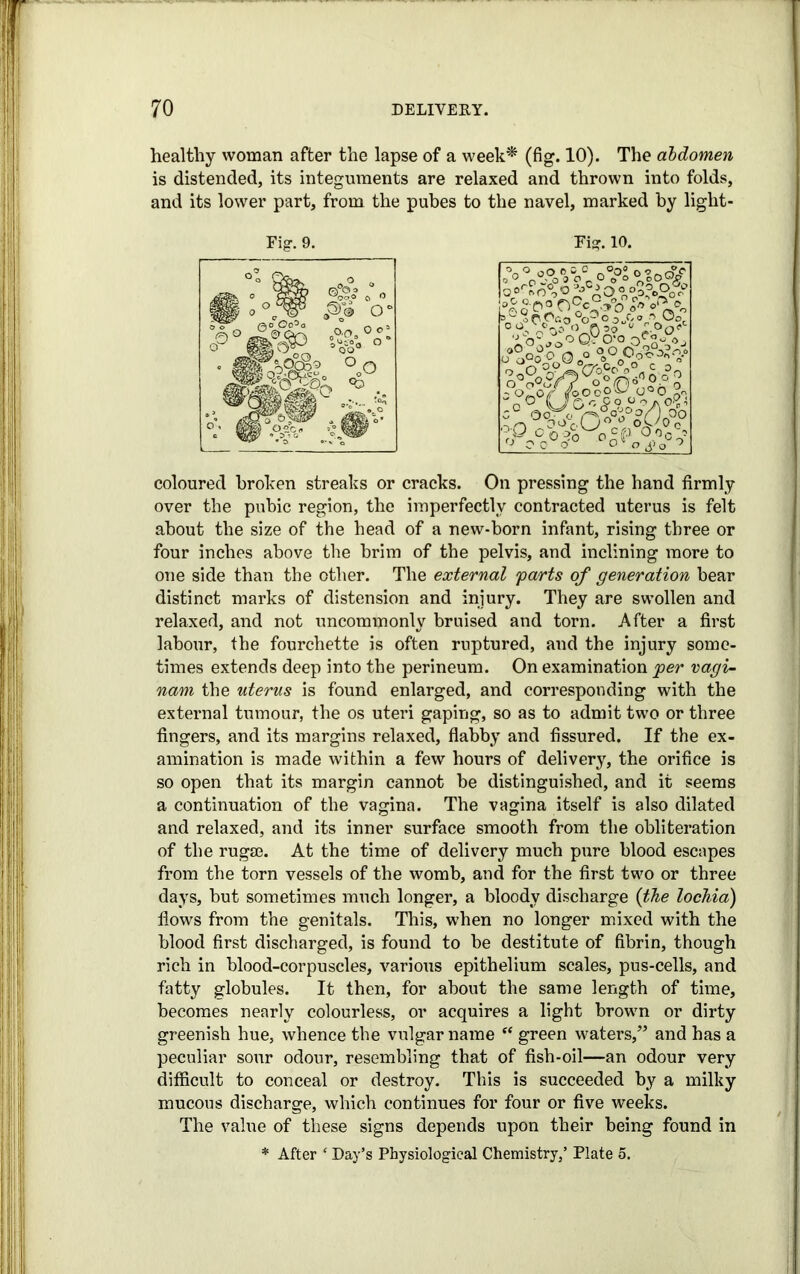 healthy woman after the lapse of a week* (fig. 10). The abdomen is distended, its integuments are relaxed and thrown into folds, and its lower part, from the pubes to the navel, marked by liglit- Fig. 9. Fig. 10. |o°r£fA O % A O ° °0?c>9oO ‘nO O.po QC-G-° p- n “■ ° „cos\o5« ;°op °^U°0°S^A^ ;° Q =Y I Oo ^ 0^rCj° oyo0 !'P C0oCn%cfJ Oo0®? Oc> >-o<- o o rPc°0fo~oM O'-ofo coloured broken streaks or cracks. On pressing the hand firmly over the pubic region, the imperfectly contracted uterus is felt about the size of the head of a new-born infant, rising three or four inches above the brim of the pelvis, and inclining more to one side than the other. The external 'parts of generation bear distinct marks of distension and injury. They are swollen and relaxed, and not uncommonly bruised and torn. After a first labour, the fourchette is often ruptured, and the injury some- times extends deep into the perineum. On examination per vagi- nani the uterus is found enlarged, and corresponding with the external tumour, the os uteri gaping, so as to admit two or three fingers, and its margins relaxed, flabby and fissured. If the ex- amination is made within a few hours of delivery, the orifice is so open that its margin cannot be distinguished, and it seems a continuation of the vagina. The vagina itself is also dilated and relaxed, and its inner surface smooth from the obliteration of the rugae. At the time of delivery much pure blood escapes from the torn vessels of the womb, and for the first two or three days, but sometimes much longer, a bloody discharge (the lochia) flows from the genitals. This, when no longer mixed with the blood first discharged, is found to be destitute of fibrin, though rich in blood-corpuscles, various epithelium scales, pus-cells, and fatty globules. It then, for about the same length of time, becomes nearly colourless, or acquires a light brown or dirty greenish hue, whence the vulgar name “ green waters,” and has a peculiar sour odour, resembling that of fish-oil—an odour very difficult to conceal or destroy. This is succeeded by a milky mucous discharge, which continues for four or five weeks. The value of these signs depends upon their being found in * After ‘ Day’s Physiological Chemistry,’ Plate 5.