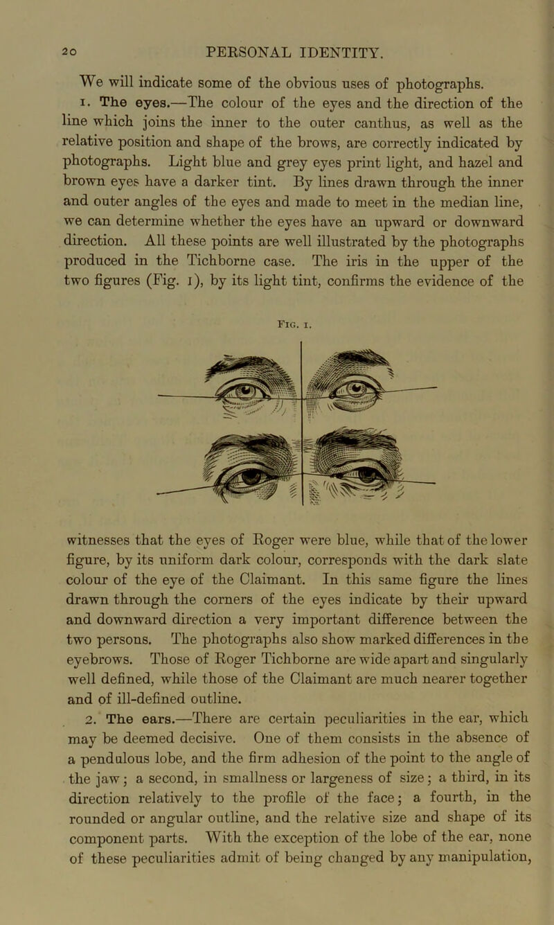 We will indicate some of the obvious uses of photographs. I. The eyes.—The colour of the eyes and the direction of the line which joins the inner to the outer canthus, as well as the relative position and shape of the brows, are correctly indicated by photographs. Light blue and grey eyes print light, and hazel and brown eyes have a darker tint. By lines drawn through the inner and outer angles of the eyes and made to meet in the median line, we can determine whether the eyes have an upward or downward direction. All these points are well illustrated by the photographs produced in the Tichborne case. The iris in the upper of the two figures (Fig- i), by its light tint, confirms the evidence of the Fig. I. witnesses that the eyes of Roger were blue, while that of the lower figure, by its uniform dark colour, corresponds with the dark slate colour of the eye of the Claimant. In this same figure the lines drawn through the corners of the eyes indicate by their upward and downward direction a very important difference between the two persons. The photographs also show marked differences in the eyebrows. Those of Roger Tichborne are wide apart and singularly well defined, while those of the Claimant are much nearer together and of ill-defined outline. 2. The ears.—There are certain peculiarities in the ear, which may be deemed decisive. One of them consists in the absence of a pendulous lobe, and the firm adhesion of the point to the angle of the jaw; a second, in smallness or largeness of size; a third, in its direction relatively to the profile of the face; a fourth, in the rounded or angular outline, and the relative size and shape of its component parts. With the exception of the lobe of the ear, none of these peculiarities admit of being changed by any manipulation,