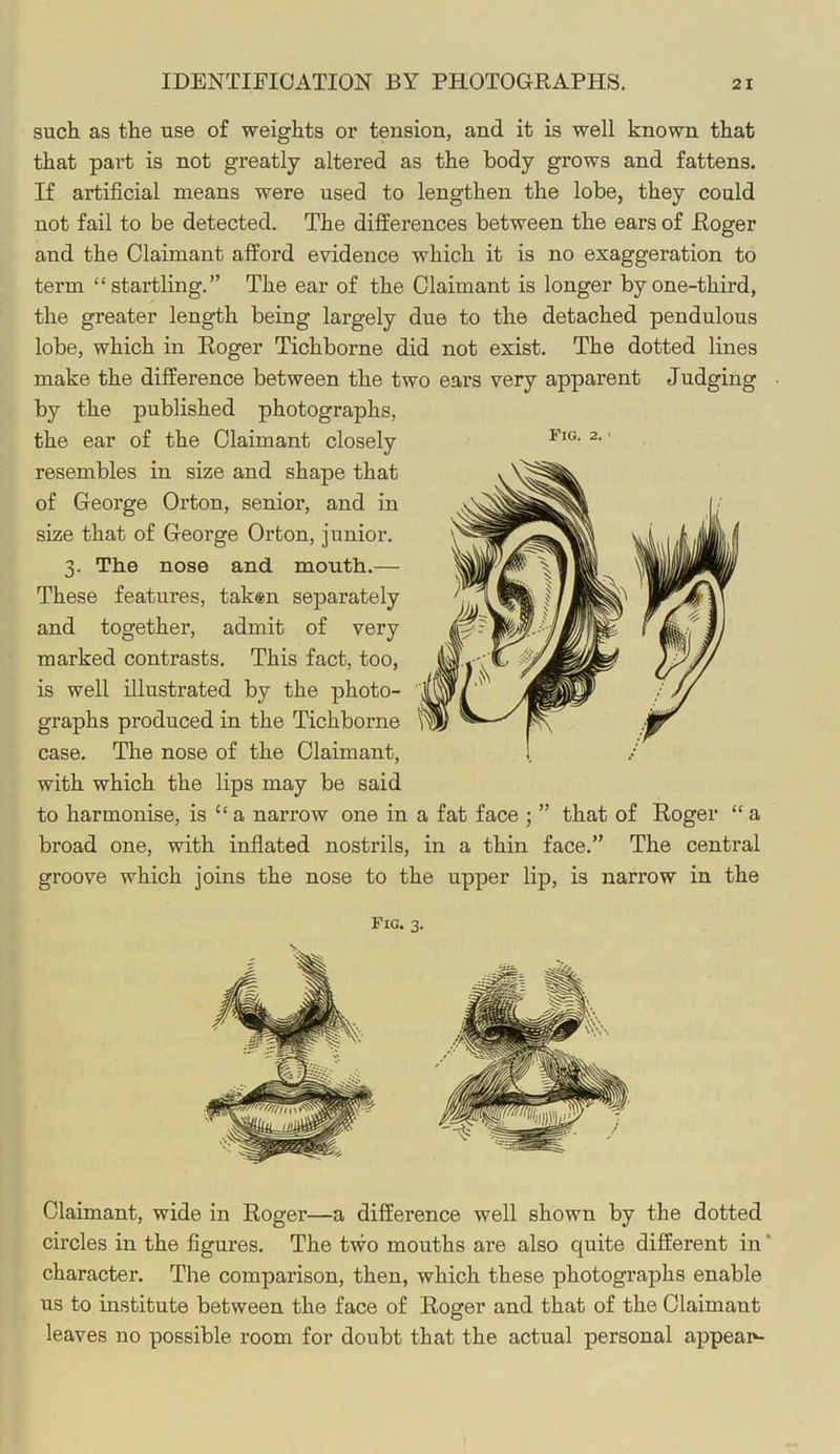 Fig. 2. such as the use of weights or tension, and it is well known that that part is not greatly altered as the body grows and fattens. If artificial means were used to lengthen the lobe, they could not fail to be detected. The differences between the ears of Eoger and the Claimant afford evidence which it is no exaggeration to term “startling.” The ear of the Claimant is longer by one-third, the greater length being largely due to the detached pendulous lobe, which in Eoger Tichborne did not exist. The dotted lines make the difference between the two ears very apparent Judging by the published photographs, the ear of the Claimant closely resembles in size and shape that of George Orton, senior, and in size that of George Orton, junior. 3. The nose and month.— These features, taken separately and together, admit of very marked contrasts. This fact, too, is well illustrated by the photo- graphs produced in the Tichborne case. The nose of the Claimant, with which the lips may be said to harmonise, is “a narrow one in a fat face broad one, with inflated nostrils, in a thin face.” The central groove which joins the nose to the upper lip, is narrow in the that of Roger “ a Fig. 3. Claimant, wide in Roger—a difference well shown by the dotted circles in the figures. The tvvo mouths are also quite different in * character. The comparison, then, which these photographs enable us to institute between the face of Roger and that of the Claimant leaves no possible room for doubt that the actual personal appear-