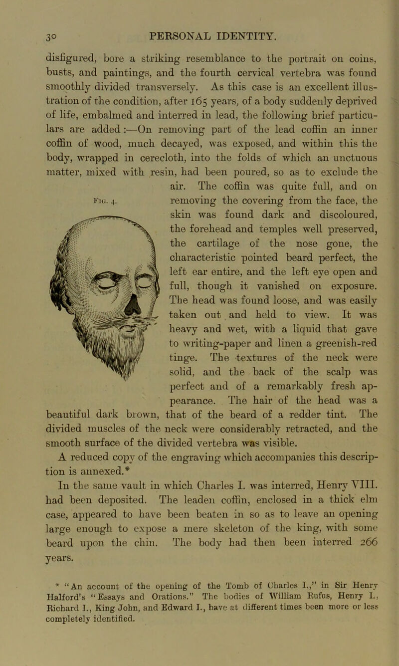 disfigured, bore a striking resemblance to the portrait on coins, busts, and paintings, and the fourth cervical vertebra was found smoothly divided transversely. As this case is an excellent illus- tration of the condition, after 165 years, of a body suddenly deprived of life, embalmed and interred in lead, the following brief particu- lars are added:—On removing part of the lead coffin an inner coffin of wood, much decayed, was exposed, and within this the body, wrapped in cerecloth, into the folds of which an unctuous matter, mixed with resin, had been poured, so as to exclude the air. The coffin was quite full, and on removing the covering from the face, the skin was found dark and discoloured, the forehead and temples well preserved, the cartilage of the nose gone, the characteristic pointed beard perfect, the left ear entire, and the left eye open and full, though it vanished on exposure. The head was found loose, and was easily taken out and held to view. It was heavy and wet, with a liquid that gave to writing-paper and linen a greenish-red tinge. The textures of the neck were solid, and the back of the scalp was perfect and of a remarkably fresh ap- pearance. The hair of the head was a beautiful dark brown, that of the beard of a redder tint. The divided muscles of the neck were considerably retracted, and the smooth surface of the divided vertebra was visible. A reduced copy of the engraving which accompanies this descrip- tion is annexed.* In the same vault in which Charles I. was interred, Henry YIII. had been deposited. The leaden coffin, enclosed in a thick elm case, appeared to have been beaten in so as to leave an opening large enough to expose a mere skeleton of the king, with some beard upon the chin. The body had then been interred 266 years. Fui. 4. * “An account of the opening of the Tomb of Charles I.,” in Sir Henry Halford's “Essays and Orations.” The bodies of William Eufus, Henry 1., Richard I., King John, and Edward I., have at different times been more or less completely identified.