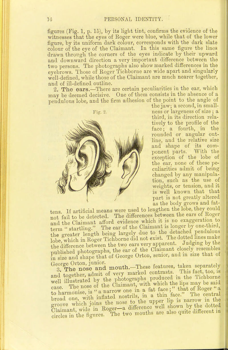 figures (Fig. 1, p. 15), by its liglit tint, confirms the evidence of the witnesses that the eyes of Roger were blue, while that of the lower figure, by its uniform dark colour, corresponds with the dark slate colour of the eye of the Claimant. In this same figure the linos drawn through the corners of the eyes indicate by their upward and downward direction a very important difference between the two persons. The photographs also show marked differences in the eyebrows. Those of Roger Tichborne are wide apart and singularly well-defined, while those of the Claimant are much nearer together, and of ill-defined outline. 2. The ears.—There are certain peculiarities in the ear, which may be deemed decisive. One of them consists in the absence of a pendulous lobe, and the firm adhesion of the point to the angle of the jaw; a second, in small- Fig:, i. ness or largeness of size ; a third, in its direction rela- tively to the profile of the face; a fourth, in the rounded or angular out- line, and the relative size and shape of its com- ponent parts. AVitli the exceiotion of the lobe of the ear, none of these pe- culiarities admit of being changed by any manipula- tion, such as the use of weights, or tension, and it is well known that that part is not greatly altered as the body grows and fat- tens If artificial means were used to lengthen the lobe, they could not fail to be detected. The differences between the ears of Roger and the Claimant afford evidence which it is no exaggeration to term  startling. The ear of the Claimant is longer by one-third, the ereater length being largely due to the detached pendulous kbe which in Roger TichbornI did n^ exist. The dotted Imes make the difference between the two ears very apparent. Judging by the published photographs, the ear of the Claimant closely resembles in size and shapi that of George Orton, senior, and in size that of ^s''??he noki^'and mouth.-These features, taken separately 1 +ti7tTiPv ndmit of very marked contrasts. This fact, too, is and ^opt/^l'photographs produced in the Tichborne r S note of thr cCrnt,'witl/which the lips may be said case. xuL uuo one in a fat face; that of Roger a IroaZS Si h iXti nostril,, in a thin face. The centra j^e-SicJ j»iv„''r°r«frctc:Tcii l;:nsre Sr?i\^4Se? ¥h7t^^^^ - ^* different i.