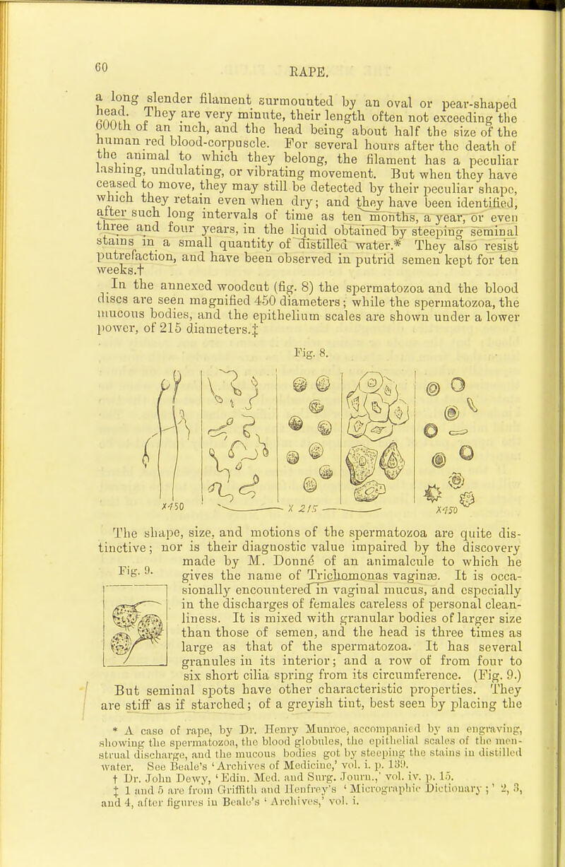 a long slender filament surmounted by an oval or pear-shaped f-n^n / -^^'^n ^^^'^ mmute, their length often not exceeding the bUUthot an mch, and the head being about half the size of the human red blood-corpuscle. For several hours after the death of the animal to which they belong, the filament has a peculiar lashing, undulating, or vibrating movement. But when they have ceased to move, they may still be detected by their peculiar shape, which they retain even when dry; and they have been identified, £ilter such long intervals of time as ten months, a year, or even three and four 3'ears, in the liquid obtained by steeping seminal stains m a small quantity of distilled water.* They also resist putrefaction, and have been observed in putrid semen kept for ten weeks.T In the annexed woodcut (fig. 8) the spermatozoa and the blood discs are seen magnified 4-50 diameters; while the spermatozoa, the mucous bodies, and the epithelium scales are shown under a lower power, of 215 diameters.^; X-1S0 Fig. 9. The shape, size, and motions of the spermatozoa are quite dis- tinctive ; nor is their diagnostic value impaired by the discovery made by M. Donne of an animalcule to which he gives the name of Trichojuonas vaginae. It is occa- sionally encounterednmvaginal mucus, and especially in the discharges of females careless of personal clean- liness. It is mixed with granular bodies of larger size than those of semen, and the head is three times as large as that of the spermatozoa. It has several granules in its interior; and a row of from four to six short cilia spring from its circumference. (Fig. 9.) But seminal spots have other characteristic properties. They are stifi^ as if starched; of a greyish tint, best seen by placing the case of rape, by Dr. Henry Muuroe, accninjianip.d by an piigraviiig, ? tlie spermatozoa, the blood globules, tlio epithelial scales of the meii- ischarge, aud the mucous bodies got by steeping the stains iu distilled * A case showing strual disch.i,if^i., . c> ^ 1 ■-> water. See Beale's 'Archives of Medicine,' vol. i. p. lii'.K t Dr. John Dewy, 'Edin. Med. aud Surg. .Jouvn.,' vol. iv. p. l.i. 1 and 5 are from Grifftth and llenfrey's ' Micrograpliie Dictionary ;' I A -./l. ........ :.. ■D..«l..*.-i I A i<n1i i \ri>i:< ' 1 and 4, after figures iu Beale's ' Arcliives,' vol. i.