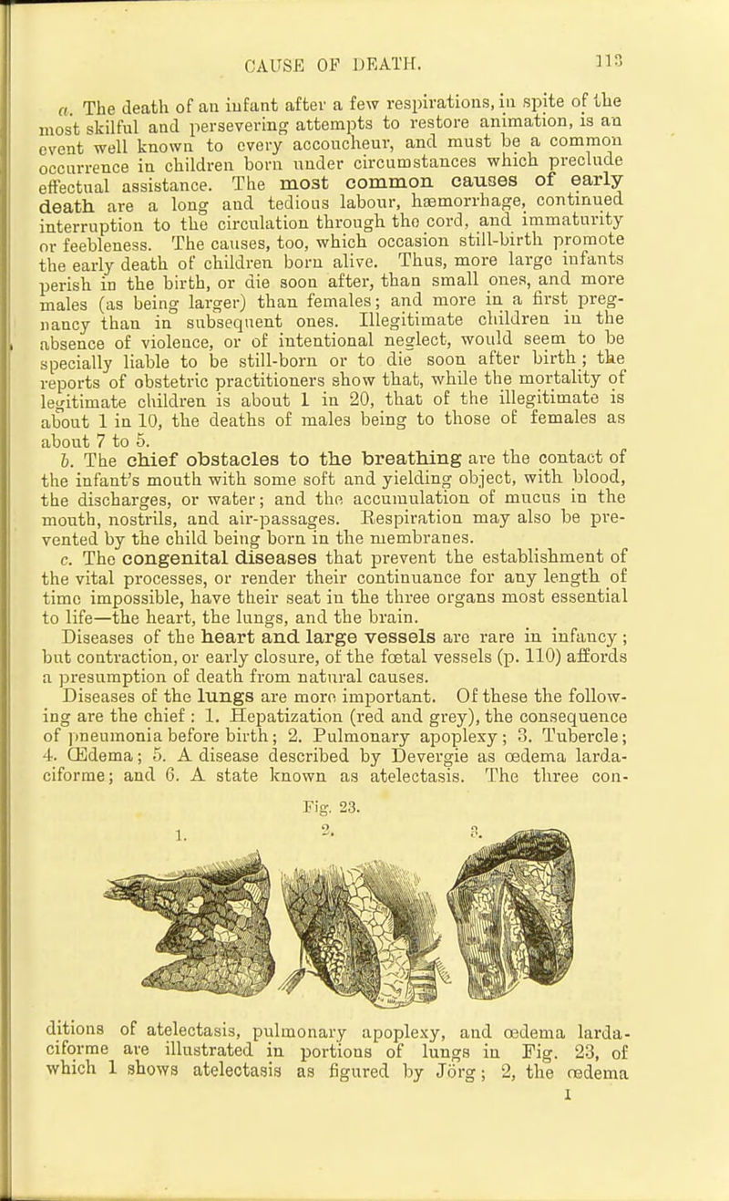 CAUSE OF DEATH. ]13 a. The death of an iufant after a few respirations, in spite of the most skilful and persevering attempts to restore animation, is an event well known to every accoucheur, and must be a common occurrence in children born under circumstances which preclude effectual assistance. The most common causes of early- death are a long and tedious labour, haemorrhage, continued interruption to the circulation through the cord, and immaturity or feebleness. The causes, too, which occasion still-birth promote the early death of children born alive. Thus, more large infants perish in the birth, or die soon after, than small ones, and more males (as being larger) than females; and more in a first preg- nancy than in subsequent ones. Illegitimate children in the absence of violence, or of intentional neglect, would seem to be specially liable to be still-born or to die soon after birth ; the reports of obstetric practitioners show that, while the mortality of legitimate children is about 1 in 20, that of the illegitimate is about 1 in 10, the deaths of males being to those of females as about 7 to 6. h. The chief obstacles to the breathing are the contact of the infant's mouth with some soft and yielding object, with blood, the discharges, or water; and the accumulation of mucus in the mouth, nostrils, and air-passages. Eespiration may also be pre- vented by the child being born in the membranes. c. The congenital diseases that prevent the establishment of the vital processes, or render their continuance for any length of time impossible, have their seat in the three organs most essential to life—the heart, the lungs, and the brain. Diseases of the heart and large vessels are rare in infancy ; but contraction, or early closure, of the foetal vessels (p. 110) afford.s a presumption of death from natural causes. Diseases of the lungs are more important. Of these the follow- ing are the chief : 1. Hepatization (red and grey), the consequence of ])neumonia before birth; 2. Pulmonary apoplexy; 3. Tubercle; 4. CEdema; 5. A disease described by Devergie as oedema larda- ciforme; and 6. A state known as atelectasis. The three con- Pig. 23. ditions of atelectasis, pulmonary apoplexy, and oedema larda- ciforme are illustrated in portions of lungs in Fig. 23, of which 1 shows atelectasis as figured by Jorg; 2, the oedema