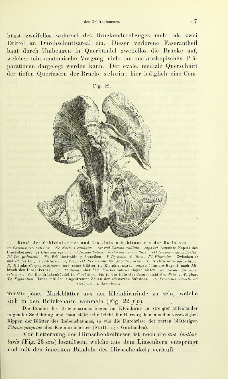büsst zweifellos während des Brückendurchzuges mehr als zwei Drittel an Durchschnittsareal ein. Dieser verlorene Faserantheil baut durch Umbeugen in Querbündel zweifellos die Brücke auf, welcher fein anatomische Vorgang nicht an makroskopischen Prä- parationen dargelegt werden kann. Der ovale, mediale Querschnitt der tiefen Querfasern der Brücke scheint hier lediglich eine Com- Fig. 22. Bruch des Geliirnstamraes und des kleinen Gehirnes von der Basis aus. ca Commissara anterior. Nc Nucleus caudatus. corrcid Corona radiata. caps ccct Aeussere Kapsel des Linsenkernes. II Chiasma opticum J Infundibulum. m Corpus mammillare. III Nervus oculomotorius. Pd Pes pedunculi. Tm Schläfestrahlung desselben. P Pyramis. 0 Oliva. Fl Flocculus. Zwischen 0 und Fl das Corpus restiforme. V, VII, VIII Nervus quintus, facialis, acusticus. x Deeussatio pyramiclum. R, R links Corpus restiforme und seine Blätter im Kleinhirnmark, caps int Innere Kapsel nach Ab- bruch des Linsenkernes. Th. Thalamus über dem Tractus opticus abgeschnitten, y e Corpus geniculum externum. fp Die Brückenbündel im Cerebelhm, bis in die tiefe Querfaserschicht des Pons verfolgbar. Tg Tegmentum, Haube mit den eingestreuten Zellen der schwarzen Substanz. Pr Processus cerebelli ad cerebrum. L Lemniscus. missur jener Markblätter aus der Kleinhirnrinde zu sein, welche sich in den Brückenarm sammeln (Fig. 22 fp). Die Bündel des Brückenarmes liegen im Kleinhirne in strenger aufeinander folgender Schichtung und man sieht sehr leicht ihr Hervorgehen aus den verzweigten Rippen der Blätter des Lebensbaumes, so wie die Durchrisse der zarten blätterigen Fibrcie propriae des Kleinhirnmarkes (Stilling’s Guirlanden). Vor Entfernung des Hirnschenkelfusses ist noch die ans. lenticu- laris (Fig. 23 ans) loszulösen, welche aus dem Linsenkern entspringt und mit den innersten Bündeln des ITirnschenkels verläuft.