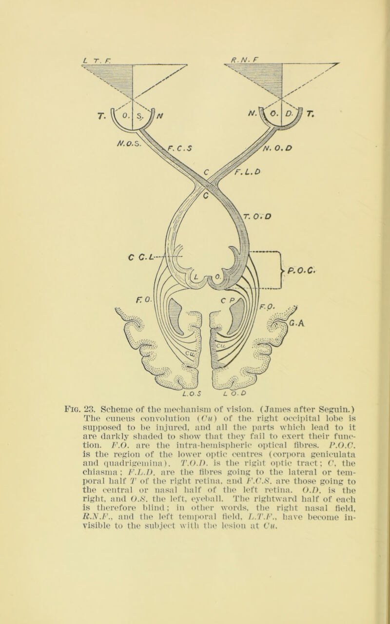 Fig. 23. Scheme of the meclmnisin of vision. (.Tames after Seguin.) The cunens convolution (Tf/) of the rifiht occipital lobe is supposed to 1)0 injured, and all the i)arts whicli lead to it are darkly shaded to show that they fail to exert their func- tion. F.O. are the intra-hemispheric o])tical fibres. P.O.C. is the rcfiion of the lower optic centres (cor])ora geniculata and (piadrisioiiuna). T.O.I). is the riii’nt o])tic tract; (\ the chiasma; F.L.D. are the fibres jxoing to the lateral or tem- poral half T of the risibt retina, and F.V.F. are those going to the central or nasal half of the left retina. (>./). is the right, and 0.*V. the left, eyeball. The rightward half of each is then'fore blind; in oflu'r words, the right nasal field. H.N.F., and the left teini)oral field. L.T.F., have become in- visible to the subject with the lesion at Cti. I