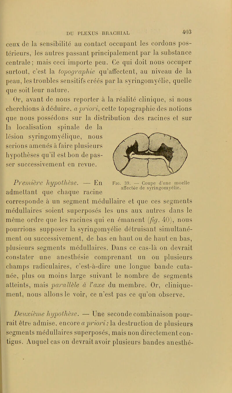 ceux de la sensibilité au contact occupant les cordons pos- térieurs, les autres passant principalement par la substance centrale; mais ceci importe peu. Ce qui doit nous occuper surtout, c’est la topographie qu’affectent, au niveau de la peau, les troubles sensitifs créés par la syringomyélie, quelle que soit leur nature. Or, avant de nous reporter à la réalité clinique, si nous cherchions à déduire, a priori, cette topographie des notions que nous possédons sur la distribution des racines et sur la localisation spinale de la lésion syringomyélique, nous serions amenés à faire plusieurs hypothèses qu’il est bon de pas- ser successivement en revue. Première liypothese. — En Fig. 39. — Coupe d’une moelle . . affectée de syringomyélie. admettant que chaque racine corresponde à un segment médullaire et que ces segments médullaires soient superposés les uns aux autres dans le même ordre que les racines qui en émanent (ftg. 40), nous pourrions supposer la syringomyélie détruisant simultané- ment ou successivement, de bas en haut ou de haut en bas, plusieurs segments médullaires. Dans ce cas-là on devrait constater une anesthésie comprenant un ou plusieurs champs radiculaires, c’est-à-dire une longue bande cuta- née, plus ou moins large suivant le nombre de segments atteints, mais parallèle à l’axe du membre. Or, clinique- ment, nous allons le voir, ce n’est pas ce qu’on observe. Deuxième hypothèse. — Une seconde combinaison pour- rait être admise, encore a priori: la destruction de plusieurs segments médullaires superposés, mais non directement con- tigus. Auquel cas on devrait avoir plusieurs bandes anesthé-