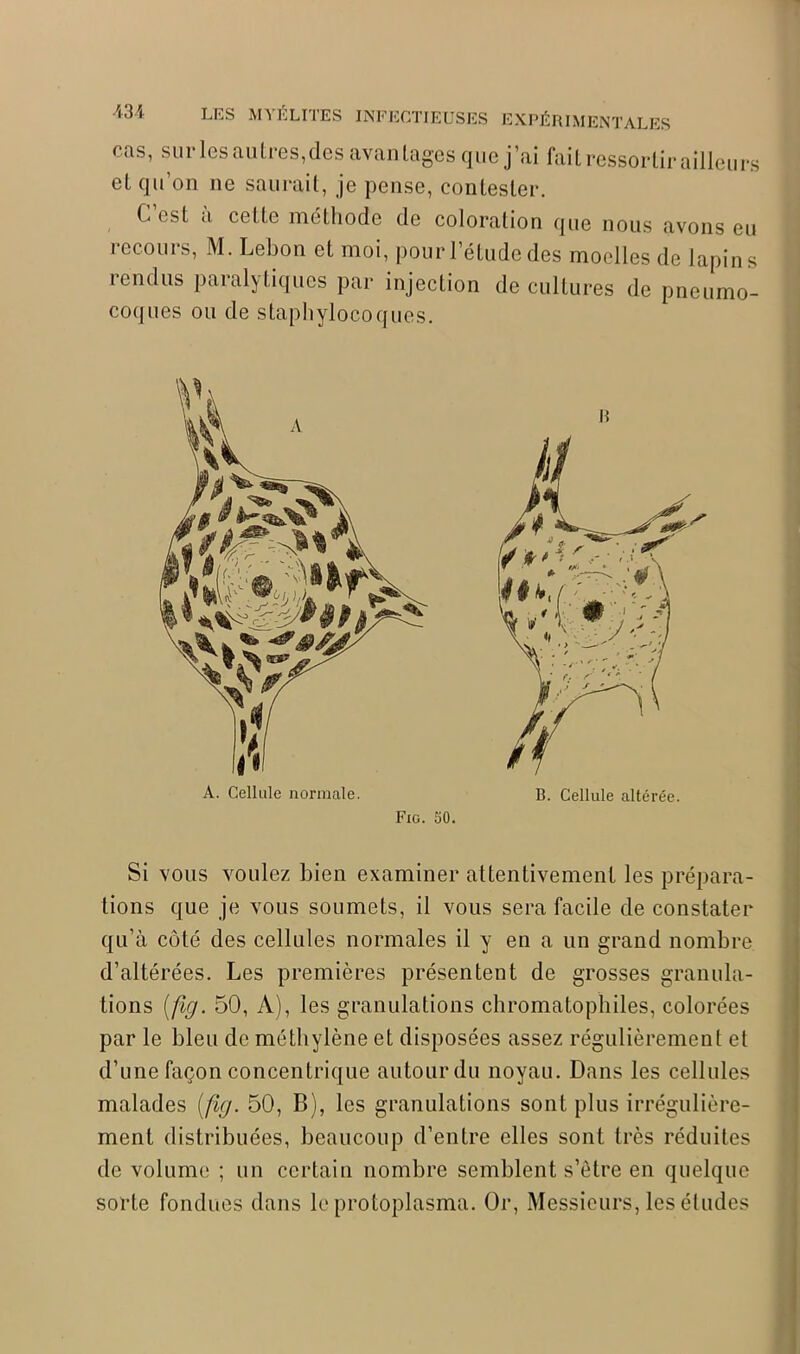 et qu’on ne saurait, je pense, contester. C est a cette méthode de coloration que nous avons eu recours, M. Lebon et moi, pour l’étude des moelles de lapins rendus paralytiques par injection de cultures de pneumo- coques ou de staphylocoques. Si vous voulez bien examiner attentivement les prépara- tions que je vous soumets, il vous sera facile de constater qu’à côté des cellules normales il y en a un grand nombre d’altérées. Les premières présentent de grosses granula- tions (fig. 50, A), les granulations chromatophiles, colorées par le bleu de méthylène et disposées assez régulièrement et d’une façon concentrique autour du noyau. Dans les cellules malades (fig. 50, B), les granulations sont plus irrégulière- ment distribuées, beaucoup d’entre elles sont très réduites de volume ; un certain nombre semblent s’être en quelque sorte fondues dans le protoplasma. Or, Messieurs, les éludes A. Cellule normale. B. Cellule altérée. Fig. 50.