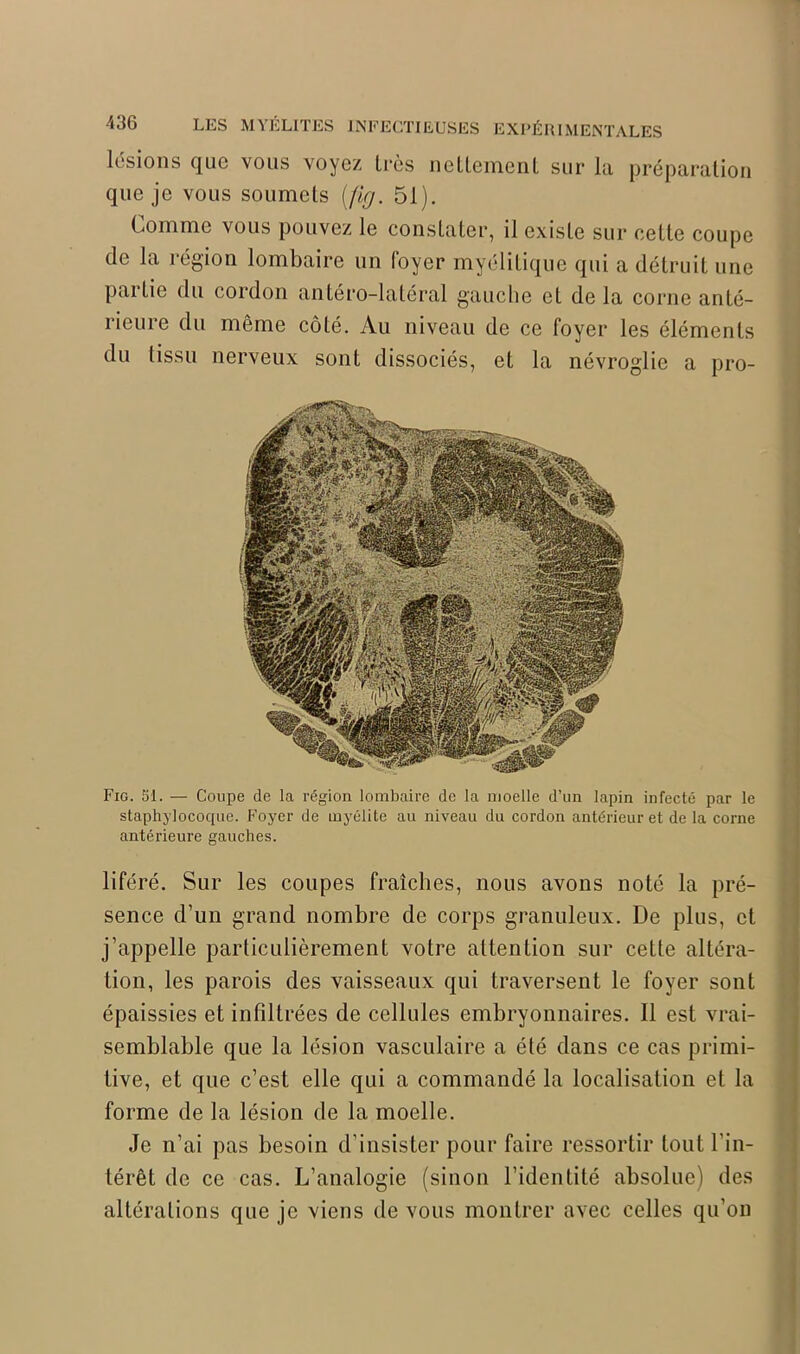 lésions que vous voyez très nettement sur la préparation que je vous soumets (fig. 51). Comme vous pouvez le constater, il existe sur cette coupe de la région lombaire un foyer myélitique qui a détruit une paitie du cordon antéro-latéral gauche et de la corne anté- rieure du même côté. Au niveau de ce foyer les éléments du tissu nerveux sont dissociés, et la névroglie a pro- Fig. 51. — Coupe de la région lombaire de la moelle d’un lapin infecté par le staphylocoque. Foyer de myélite au niveau du cordon antérieur et de la corne antérieure gauches. liféré. Sur les coupes fraîches, nous avons noté la pré- sence d’un grand nombre de corps granuleux. De plus, et j’appelle particulièrement votre attention sur cette altéra- tion, les parois des vaisseaux qui traversent le foyer sont épaissies et infiltrées de cellules embryonnaires. Il est vrai- semblable que la lésion vasculaire a été dans ce cas primi- tive, et que c’est elle qui a commandé la localisation et la forme de la lésion de la moelle. Je n’ai pas besoin d’insister pour faire ressortir tout l'in- térêt de ce cas. L’analogie (sinon l’identité absolue) des altérations que je viens de vous montrer avec celles qu’on