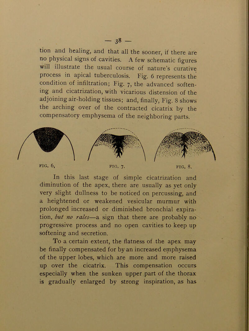 tion and healing, and that all the sooner, if there are no physical signs of cavities. A few schematic figures will illustrate the usual course of nature’s curative process in apical tuberculosis. Fig. 6 represents the condition of infiltration; Fig. 7, the advanced soften- ing and cicatrization, with vicarious distension of the adjoining air-holding tissues; and, finally. Fig. 8 shows the arching over of the contracted cicatrix by the compensatory emphysema of the neighboring parts. PIG- 6, FIG. 7. fig. 8. In this last stage of simple cicatrization and diminution of the apex, there are usually as yet only very slight dullness to be noticed on percussing, and a heightened or weakened vesicular murmur with prolonged increased or diminished bronchial expira- tion, but no rales—a sign that there are probably no progressive process and no open cavities to keep up softening and secretion. To a certain extent, the flatness of the apex may be finally compensated for by an increased emphysema of the upper lobes, which are more and more raised up over the cicatrix. This compensation occurs especially when the sunken upper part of the thorax is gradually enlarged by strong inspiration, as has