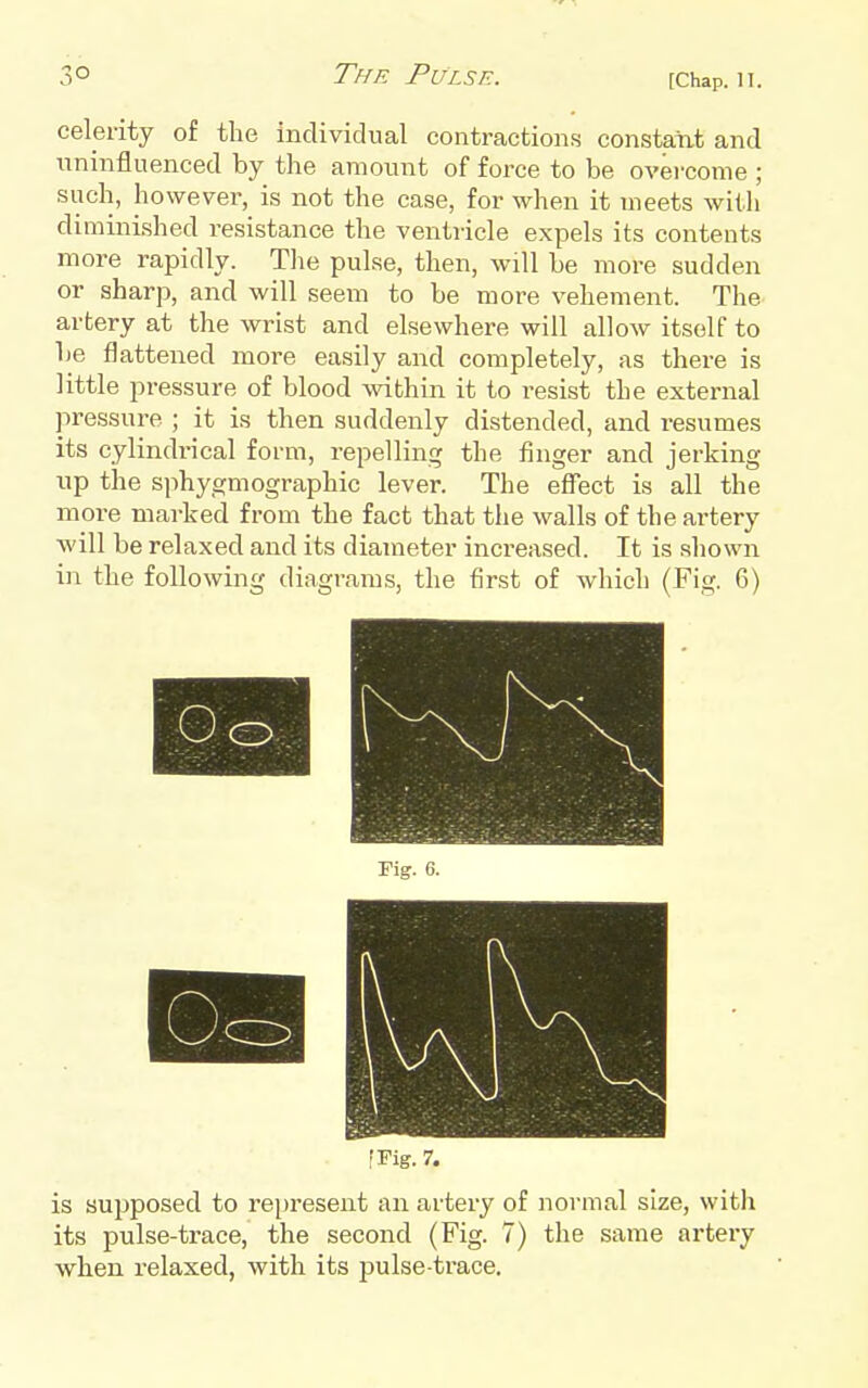 celerity of tlie individual contractions constant and uninfluenced by the amount of force to be overcome ; such, however, is not the case, for when it meets with diminished resistance the ventricle expels its contents more rapidly. Tlie pulse, then, will be more sudden or sharp, and will seem to be more vehement. The artery at the wrist and elsewhere will allow itself to be flattened more easily and completely, as there is little pressure of blood within it to resist the external pressure ; it is then suddenly distended, and resumes its cylindrical form, repelling the finger and jerking up the sphygmographic lever. The efiect is all the more marked from the fact that the walls of the artery will be relaxed and its diameter increased. It is shown in the following diagrams, the first of which (Fig. 6) [Fig. 7. is supposed to represent an artery of normal size, witli its pulse-trace, the second (Fig. 7) the same artery when relaxed, with its pulse-trace.