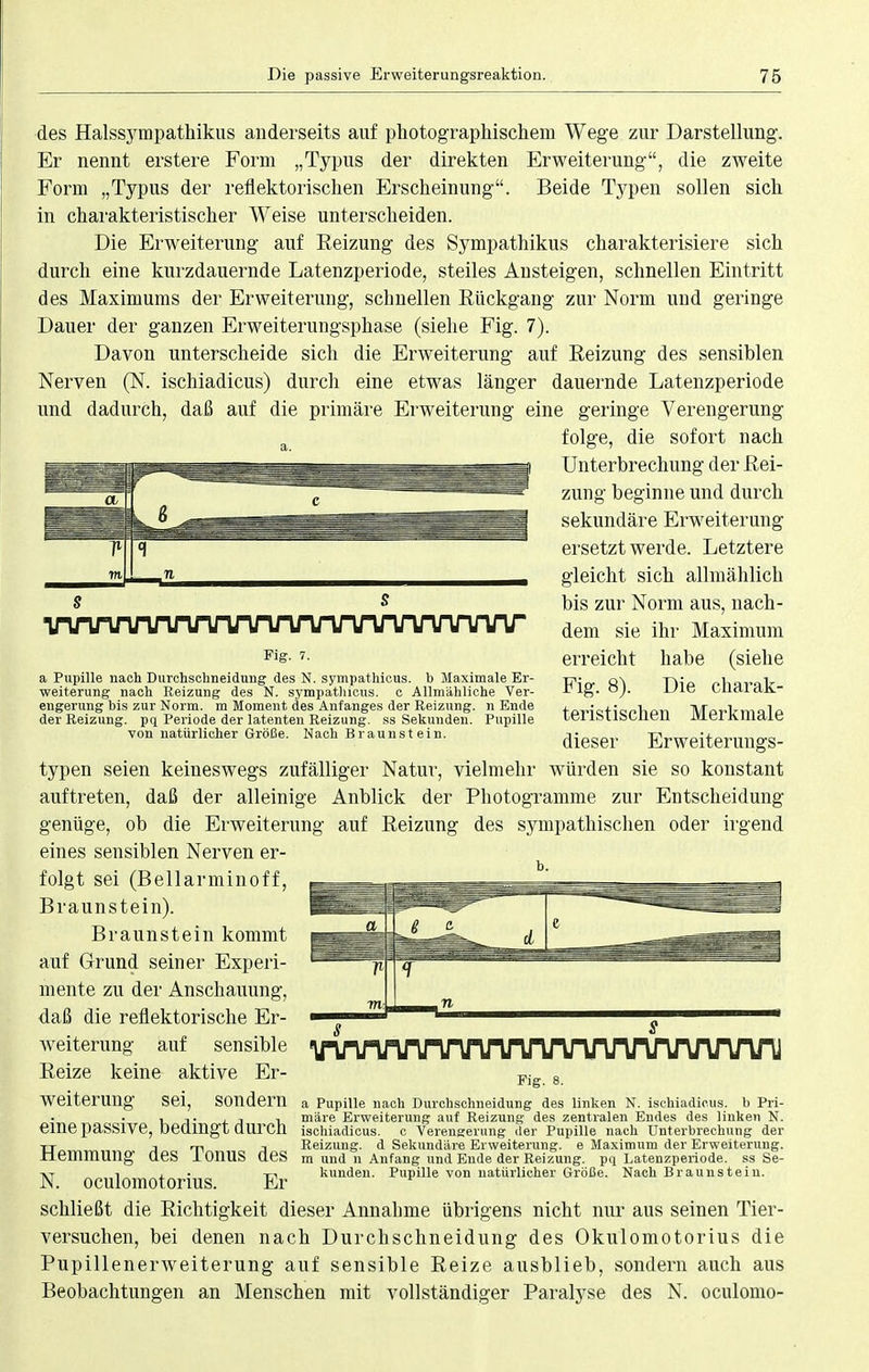 des Halssympathikus anderseits auf photographischem Wege zur Darstellung. Er nennt erstere Form „Typus der direkten Erweiterung, die zweite Form „Typus der reflektorischen Erscheinung. Beide Typen sollen sich in charakteristischer Weise unterscheiden. Die Erweiterung auf Reizung des Sympathikus charakterisiere sich durch eine kurzdauernde Latenzperiode, steiles Austeigen, schnellen Eintritt des Maximums der Erweiterung, schnellen Rückgang zur Norm und geringe Dauer der ganzen Erweiterungsphase (siehe Fig. 7). Davon unterscheide sich die Erweiterung auf Reizung des sensiblen Nerven (N. ischiadicus) durch eine etwas länger dauernde Latenzperiode und dadurch, daß auf die primäre Erweiterung eine geringe Verengerung folge, die sofort nach Unterbrechung der Rei- zung beginne und durch sekundäre Erweiterung ersetzt werde. Letztere gleicht sich allmählich bis zur Norm aus, nach- dem sie ihr Maximum erreicht habe (siehe Fig. 8). Die charak- teristischen Merkmale dieser Erweiterungs- typen seien keineswegs zufälliger Natur, vielmehr würden sie so konstant auftreten, daß der alleinige Anblick der Photogramme zur Entscheidung genüge, ob die Erweiterung auf Reizung des sympathischen oder irgend eines sensiblen Nerven er- folgt sei (Bellarminoff, Braunstein). Braunstein kommt auf Grund seiner Experi- mente zu der Anschauung, daß die reflektorische Er- weiterung auf sensible Reize keine aktive Er- weiterung sei eine passive, bedingt durch Hemmung des Tonus des N. oculomotorius. Er schließt die Richtigkeit dieser Annahme übrigens nicht nur aus seinen Tier- versuchen, bei denen nach Durchschneidung des Okulomotorius die Pupillenerweiterung auf sensible Reize ausblieb, sondern auch aus Beobachtungen an Menschen mit vollständiger Paralyse des N. oculomo- VWVYVVVVVYVVVVVYVY^ Fig. 7. a Pupille nach Durchschneidung des N. sympathicus. b Maximale Er- weiterung nach Reizung des N. sympathicus. c Allmähliche Ver- engerung bis zur Norm, m Moment des Anfanges der Reizung, n Ende der Reizung, pq Periode der latenten Reizung, ss Sekunden. Pupille von natürlicher Größe. Nach Braunstein. Fig. 8. sonder n a Pupille nach Durchschneidung des linken N. ischiadicus. b Pri- märe Erweiterung auf Reizung des zentralen Endes des linken N. ischiadicus. c Verengerung der Pupille nach Unterbrechung der Reizung, d Sekundäre Erweiterung, e Maximum der Erweiterung, m und n Anfang und Ende der Reizung, pq Latenzperiode. ss Se- kunden. Pupille von natürlicher Größe. Nach Braunstein.