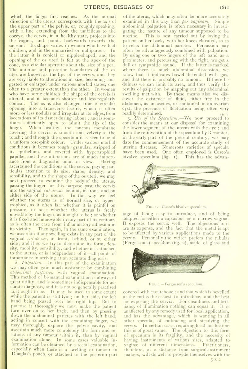 which the finger first reaches. As the normal direction of the uterus corresponds with the axis of the u|jper part of the pelvis, or, roughly speaking, with a line extending from the umbilicus to the coccyx, the cervix, in a healthy state, projects into the vagina, and points backwards towards the sacrum. Its shape varies in women who liave had children, and in the unmarried or nuUiparous. In the latter it is conical or nipple-shaped, and the i)|)eningof the os uteri is felt at the apex of the ( one, as a circular aperture about the size of a pea. The anterior and posterior boundaries of the os uteri are known as the lips of the cervix, and tiiey are very lialjle to alterations in size, becoming con- t;ested or enlarged under various morbid states, one often to a greater extent than the other. In women who have borne children the shape of the cervix is altered, and it becomes shorter and less regularly conical. The os is also changed from a circular opening into a transverse fissure, which is often more or less nodular and irregular at its edges, from lacerations ol its tissues during labour ; and is some- limes sufficiently open to admit the tip of the linger. When healthy, the mucous membrane covering the cervix is smooth and velvety to the touch ; and through the speculum it is seen to be of a imiform rose-pink colour. Under various morbid conditions it becomes rougli, granular, stripped of its epithelium, and covered with hyiJcrtrophied [)apill:v, and these alterations are of much import- ance from a diagnostic point of view. Having tscertained the conditions of the cervix, paying par- licuiar attention to its size, shape, density, and sensibility, and to the shape of the os uteri, we may next proceed to examine the body of the uterus, passing the finger for this purpose past the cervix into the vaginal cu/-d£-sac behind, in front, and on either side of the uterus. In this way we feel whether the uterus is of normal size, or hyper- irophied, as it often is; whether it is painful on pressure, or not ; whether the uterus is freely movable by the finger, as it ought to be ; or whether it is fixed and immovable in any part of its contour, as is often the case from inflammatory adhesion in its vicinity. Then again, in the same examination, we ascertain if any swelling exists in any part of the vaginal tnl-<u-sa(, in front, behind, or at either side ; and if so we try to determine its form, den- sity, mobility, sensibility, and whether it is attached lo the uterus, or is independent of it—all points of importance in arriving at an accurate diagnosis. 2. Pa/piilion. In this part of the examination we may often gain much assistance by combining abdoiniiia! f'alpation with vaginal examination. This method of bi-manual examination is always of ,,'reat utility, and is sometimes indispensable for ac- curate diagnosis, and it is not so generally practised IS it ought to he. It may Ije used to some extent while the patient is still lying on her side, the left liand being passed over her right hip. But to practise it thoroughly we must make the patient luin over on to her back, and then by pressing down the abdominal parietes with the left hand, acting in concert with the examining finger, we may thoroughly explore the pelvic cavity, and ascertain much more completely the form and re- lations of any tumour within it, than by vaginal examination alone. In some cases valuable in- lormation can be obtained by a rectal examination, especially when there is a swelling or tumour in Douglas's pouch, or attached to the posterior part of the uterus, which may often be more accurately examined in this way than per vagina/)!. Simple abdominal palpation is often necessary in investi- gating the nature of any tumour supposed to be uterine. This is best carried out \>y laying the patient on her back, with her knees elevated, so as to relax the abdominal parietes. Percussion may often be advantageously combined with palpation. By using one or two fingers of the left hand as a pleximeter, and percussing with the right, we get a dull or tympanitic sound. If the latter is marked where there is much abdominal distension, we know that it indicates bowel distended with gas, and that there is probably no tumour. If there be dulness we can limit its area, and thus verify the results of palpation by mapping out any abdominal swelling met with. By these means also we dis- cover the existence of fluid, either free in the abdomen, as in ascites, or contained in an ovarian cyst, the presence of fluctuation being often very readily determined. 3. Use of the Speciihtrn.—We now proceed to consider the means at our disposal for examining the lower segment of the uterus with the eye ; and from the re-invention of the speculum by Recamier, in the early part of the present century, we may date the commencement of the accurate study of uterine diseases. Numerous varieties of specula have been used. One often employed is Cusco's bivalve speculum (fig. l). This has the advan- FiG. I.—Cusco's bivah'e speculum. tage of being easy to introduce, and of being adapted for either a capacious or a narrow vagina. It exposes the cervix well. The objections to it are its expense, and the fact that the metal is apt to be affected by various applications made to the cervix. Personally the writer prefers the tubular (Fergusson's) speculum (fig. 2), made of glass and til.. ::. - I-clgu^son's >l)CLuIuni. covered with caoutchouc ; and that which is bevelled at the end is the easiest to introduce, and the best for exposing the cervix. For cleanliness and bril- liancy of illumination nothing can equal it. It is unafi'ecled by any remedy used for local application, and has the advantage, which is wanting in all other specula, of embracing and steadying the cervix. In certain cases reijuiring local medication this is of great value. The objection to this form of speculum is its fragility, and the necessity of having instruments of various sizes, adapted to vaginK of dift'erenl dimensions. Practitioners, therefore, at a distance from surgical-instrument makers, will do well to provide themselves with the 5 Z 2
