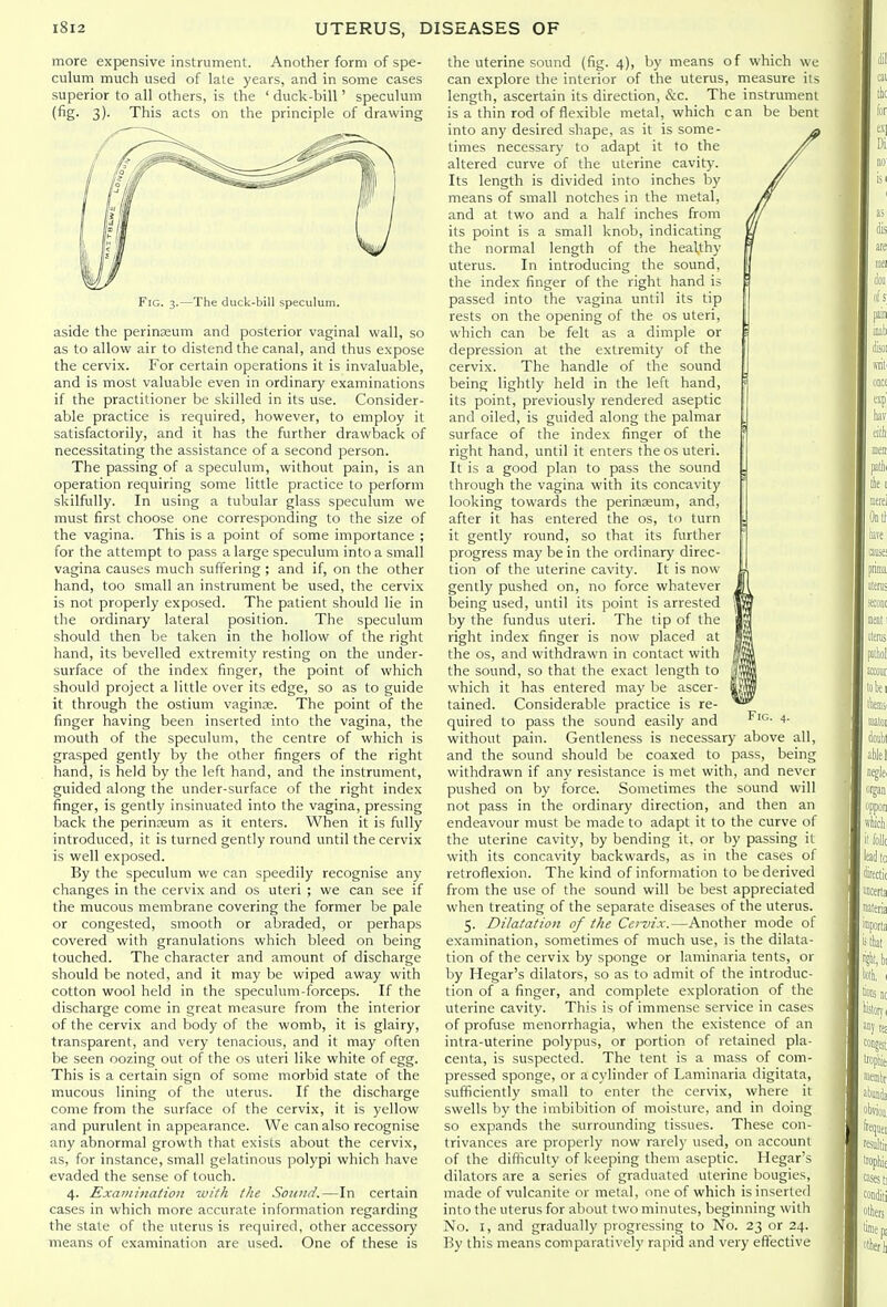 more expensive instrument. Another form of spe- culum much used of late years, and in some cases superior to all others, is the ' duck-bill' speculum (fig- 3)- This acts on the principle of drawing Fig. 3.—The duck-bill speculum. aside the perineum and posterior vaginal wall, so as to allow air to distend the canal, and thus expose the cervix. For certain operations it is invaluable, and is most valuable even in ordinary examinations if the practitioner be skilled in its use. Consider- able practice is required, however, to employ it satisfactorily, and it has the further drawback of necessitating the assistance of a second person. The passing of a speculum, without pain, is an operation requiring some little practice to perform skilfully. In using a tubular glass speculum we must first choose one corresponding to the size of the vagina. This is a point of some importance ; for the attempt to pass a large speculum into a small vagina causes much suffering ; and if, on the other hand, too small an instrument be used, the cervix is not properly exposed. The patient should lie in the ordinary lateral position. The speculum should then be taken in the hollow of the right hand, its bevelled extremity resting on the under- surface of the index finger, the point of which should project a little over its edge, so as to guide it through the ostium vagince. The point of the finger having been inserted into the vagina, the mouth of the speculum, the centre of which is grasped gently by the other fingers of the right hand, is held by the left hand, and the instrument, guided along the under-surface of the right index finger, is gently insinuated into the vagina, pressing back the perinxum as it enters. When it is fully introduced, it is turned gently round until the cervix is well exposed. By the speculum we can speedily recognise any changes in the cervix and os uteri ; we can see if the mucous membrane covering the former be pale or congested, smooth or abraded, or perhaps covered with granulations which bleed on being touched. The character and amount of discharge should be noted, and it may be wiped away with cotton wool held in the speculum-forceps. If the discharge come in great measure from the interior of the cervix and body of the womb, it is glairy, transparent, and very tenacious, and it may often be seen oozing out of the os uteri like white of egg. This is a certain sign of some morbid state of the mucous lining of the uterus. If the discharge come from the surface of the cervix, it is yellow and purulent in appearance. We can also recognise any abnormal growth that exists about the cervix, as, for instance, small gelatinous polypi which have evaded the sense of touch. 4. Examination with the Sound.—In certain cases in which more accurate information regarding the state of the uterus is required, other accessory means of examination are used. One of these is the uterine sound (fig. 4), by means of which we can explore the interior of the uterus, measure its length, ascertain its direction, &c. The instrument is a thin rod of flexible metal, which can be bent into any desired shape, as it is some- a times necessary to adapt it to the altered curve of the uterine cavity. Its length is divided into inches by means of small notches in the metal, M and at two and a half inches from Ai its point is a small knob, indicating Lf the normal length of the healthy H uterus. In introducing the sound, [ the index finger of the right hand is I passed into the vagina until its tip ; rests on the opening of the os uteri, which can be felt as a dimple or depression at the extremity of the cervix. The handle of the sound being lightly held in the left hand, ! its point, previously rendered aseptic and oiled, is guided along the palmar surface of the index finger of the ' right hand, until it enters the os uteri. It is a good plan to pass the sound . through the vagina with its concavity '\ looking towards the perinseum, and, after it has entered the os, to turn , it gently round, so that its further \ progress may be in the ordinary direc- tion of the uterine cavity. It is now : gently pushed on, no force whatever J being used, until its point is arrested by the fundus uteri. The tip of the ||I right index finger is now placed at the OS, and withdrawn in contact with IBi the sound, so that the exact length to which it has entered may be ascer- |M tained. Considerable practice is re- ^^ quired to pass the sound easily and without pain. Gentleness is necessary above all, and the sound should be coaxed to pass, being withdrawn if any resistance is met with, and never pushed on by force. Sometimes the sound will not pass in the ordinary direction, and then an endeavour must be made to adapt it to the curve of the uterine cavity, by bending it, or by passing it with its concavity backwards, as in the cases of retroflexion. The kind of information to be derived from the use of the sound will be best appreciated when treating of the separate diseases of the uterus. 5. Dilatation of the Cervix.—Another mode of examination, sometimes of much use, is the dilata- tion of the cervix by sponge or laminaria tents, or by Hegar's dilators, so as to admit of the introduc- tion of a finger, and complete exploration of the uterine cavity. This is of immense service in cases of profuse menorrhagia, when the existence of an intra-uterine polypus, or portion of retained pla- centa, is suspected. The tent is a mass of com- pressed sponge, or a cylinder of Laminaria digitata, sufficiently small to enter the cervix, where it swells by the imbibition of moisture, and in doing so expands the surrounding tissues. These con- trivances ai^e properly now rarely used, on account of the difficulty of keeping them aseptic. Hegar's dilators are a series of graduated uterine bougies, made of vulcanite or metal, one of which is inserted into the uterus for about two minutes, beginning with No. I, and gradually progressing to No. 23 or 24. By this means comparatively rapid and very effective