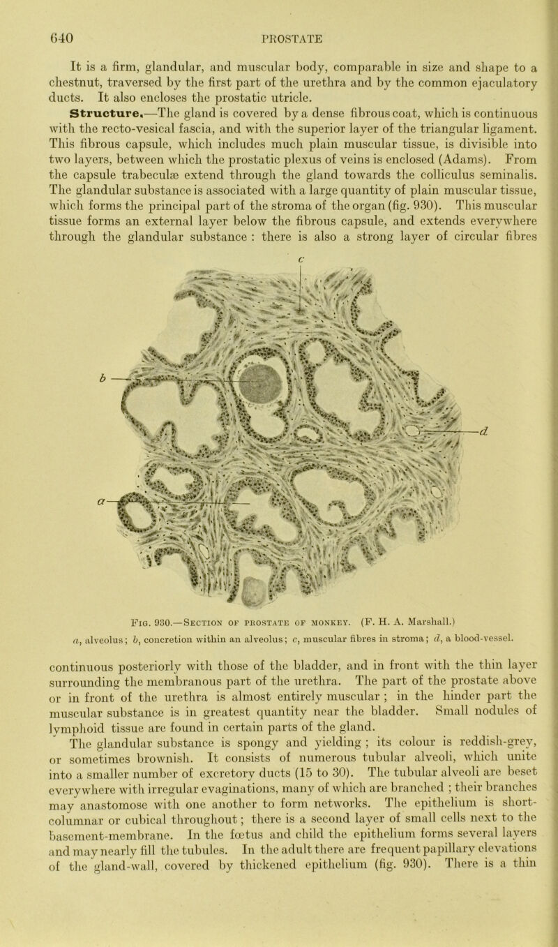 G40 ri^OSTATE It is a firm, glandular, and muscular body, comparable in size and shape to a chestnut, traversed by the first part of the urethra and by the common ejaculatory ducts. It also encloses the prostatic utricle. Structure,—The gland is covered by a dense fibrous coat, which is continuous with the recto-vesical fascia, and with the superior layer of the triangular ligament. This fibrous capsule, which includes much plain muscular tissue, is divisible into two layers, between which the prostatic plexus of veins is enclosed (Adams). From the capsule trabeculse extend through the gland towards the colliculus seminalis. The glandular substance is associated with a large quantity of plain muscular tissue, which forms the principal part of the stroma of the organ (fig. 930). This muscular tissue forms an external layer below the fibrous capsule, and extends everywhere through the glandular substance : there is also a strong layer of circular fibres c V • '(■■f ■ 1;: 'V .*• <• V, . \ W ■ V'.v n'li.' , % • ■' , i ^ -Sr ■ - ^ * . Wi • t s V •% - <v, fTvTiS., • V '■ ■ \> I ' i’/, , N ,..■>». a '* S' '' fc'i*! t' / Fig. 930.—Section of prostate of monkey. (F. H. A. Marshall.) a, alveolus; h, concretion within an alveolus; c, muscular fibres in stroma; d, a blood-vessel. continuous posteriorly with those of the bladder, and in front with the thin layer surrounding the membranous part of the urethra. The part of the prostate above or in front of the urethra is almost entirely muscular ; in the hinder part the muscular substance is in greatest quantity near the bladder. Small nodules of Ivmphoid tissue are found in certain parts of the gland. The glandular substance is spongy and yielding ; its colour is reddish-grey, or sometimes brownish. It consists of numerous tubular alveoli, which unite into a smaller number of excretory ducts (15 to 30). The tubular alveoli are beset everywhere with irregular evaginations, many of which are branched ; their branches may anastomose with one another to form networks. The epithelium is short- columnar or cubical throughout; there is a second layer of small cells next to the basement-membrane. In the foetus and child the epithelium forms several layers and may nearly fill the tubules. In the adult there are frequent papillary elevations of the gland-wall, covered by thickened epithelium (fig. 930). There is a thin