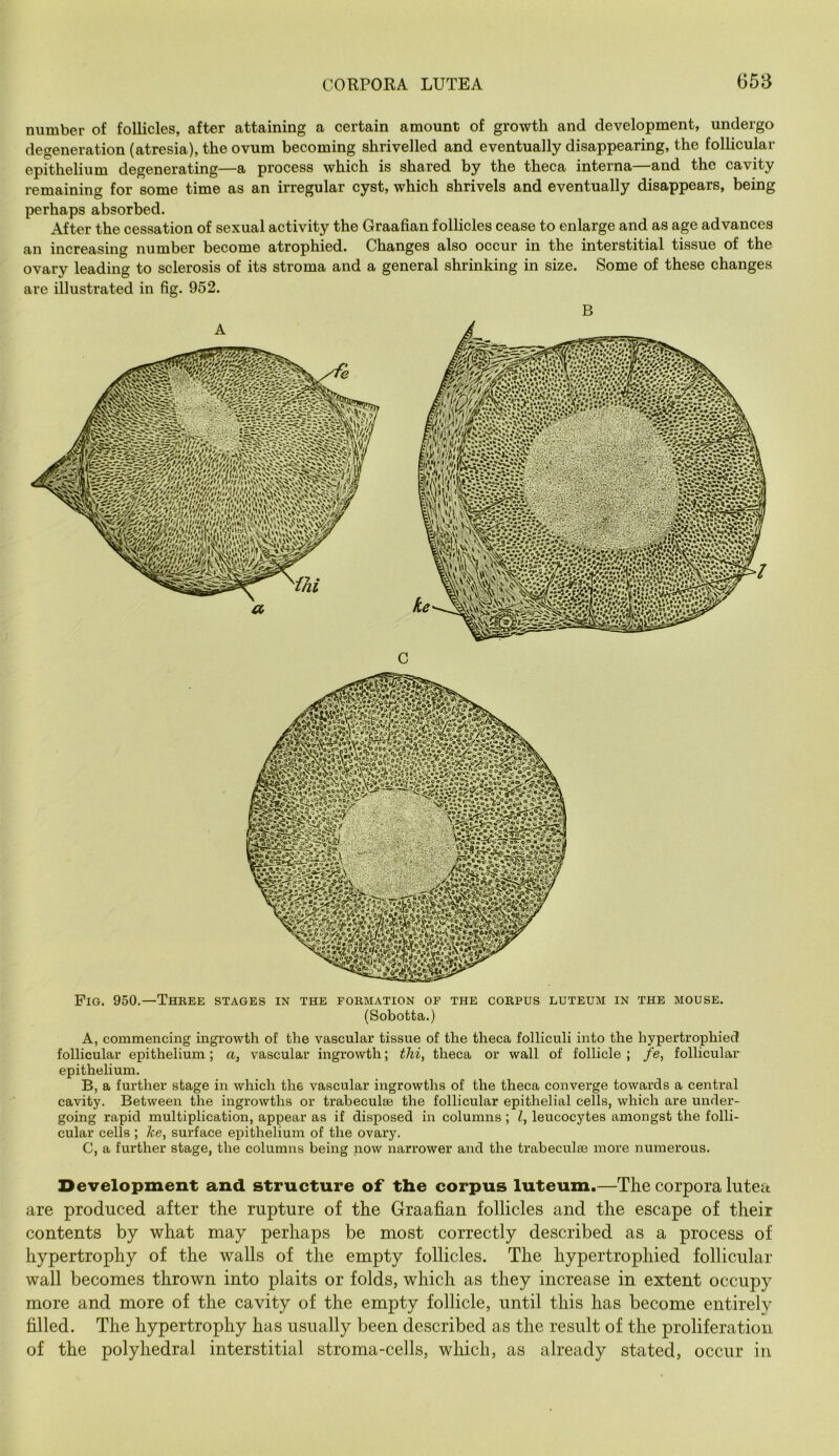 CORPORA LUTEA 658 number of follicles, after attaining a certain amount of growth and development, undergo degeneration (atresia), the ovum becoming shrivelled and eventually disappearing, the follicular epithelium degenerating—a process which is shared by the theca interna—and the cavity remaining for some time as an irregular cyst, which shrivels and eventually disappears, being perhaps absorbed. After the cessation of sexual activity the Graafian follicles cease to enlarge and as age advances an increasing number become atrophied. Changes also occur in the interstitial tissue of the ovary leading to sclerosis of its stroma and a general shrinking in size. Some of these changes are illustrated in fig. 952. B C Pig. 950.—Three stages in the formation of the corpus luteum in the mouse. (Sobotta.) A, commencing ingrowth of the vascular tissue of the theca folliculi into the hypertrophied follicular epithelium; a, vascular ingrowth; thi, theca or wall of follicle ; fe, follicular epithelium. B, a further stage in which the vascular ingrowths of the theca converge towards a central cavity. Between the ingrowths or trabeculae the follicular epithelial cells, which are under- going rapid multiplication, appear as if disposed in columns ; I, leucocytes amongst the folli- cular cells ; ke, surface epithelium of the ovary. C, a further stage, the columns being now narrower and the trabeculae more numerous. Development and structure of the corpus luteum.—The corpora lutea are produced after the rupture of the Graafian follicles and the escape of their contents by what may perhaps be most correctly described as a process of hypertrophy of the walls of the empty follicles. The hypertrophied follicular wall becomes thrown into plaits or folds, which as they increase in extent occupy more and more of the cavity of the empty follicle, until this has become entirely filled. The hypertrophy has usually been described as the result of the proliferation of the polyhedral interstitial stroma-cells, which, as already stated, occur in
