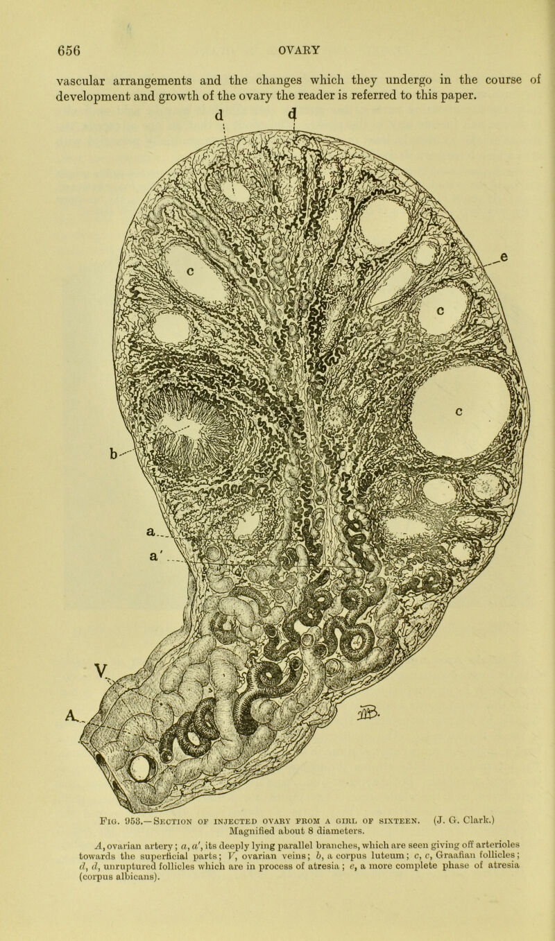 vascular arrangements and the changes which they undergo in the course of d 4 A, ovarian artery ; a, a', its deej)ly lying pai’allel branches, which are seen giving oft’ arterioles towards the superficial parts; V, ovarian veins; b, a corpus luteuin; c, c, Graaftan follicles; (1, d, unruptured follicles which are in process of atresia ; <?, a more complete phase of atresia (corpus albicans).