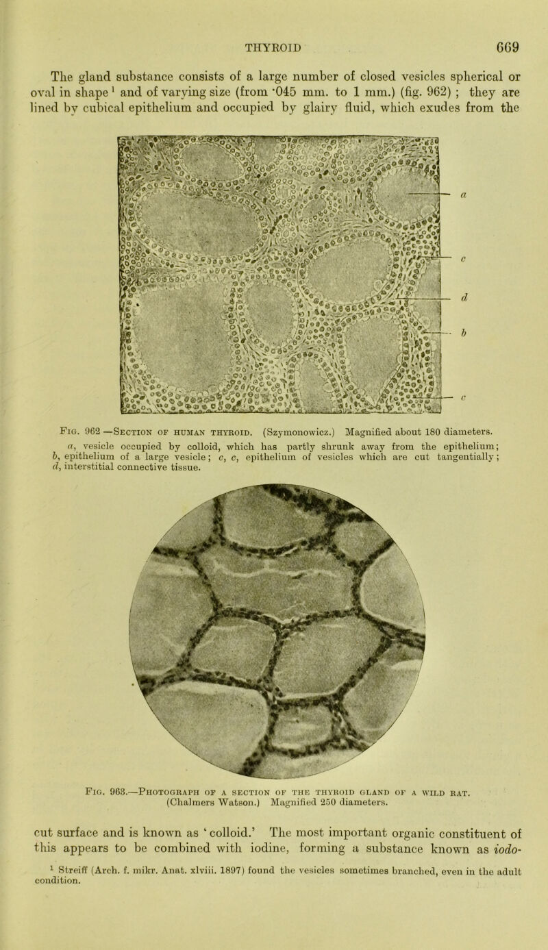 The gland substance consists of a large number of closed vesicles spherical or oval in shape ‘ and of varying size (from ‘045 mm. to 1 mm.) (fig. 962) ; they are lined by cubical epithelium and occupied by glairy fluid, which exudes from the * V . .2 V l^( J?A /^O. ^ a\¥< . • ‘ ‘ ' wA ,®r i®'' a cl h Fig. 962 —Section of human thyroid. (Szymonowicz.) Magnified about 180 diameters. a, vesicle occupied by colloid, which has partly shrunk away from the epithelium; &, epithelium of a large vesicle; c, c, epithelium of vesicles which are cut tangentially; d, interstitial connective tissue. Fig. 963.—Photograph op a section of the thyroid gland of a wild rat. (Chalmers Watson.) Magnified 250 diameters. cut surface and is known as ‘ colloid.’ The most important organic constituent of this appears to be combined with iodine, forming a substance known as iodo- ^ Streiff (Arch. f. mikr. Anat. xlviii. 1897) found the vesicles sometimes branched, even in the adult condition.