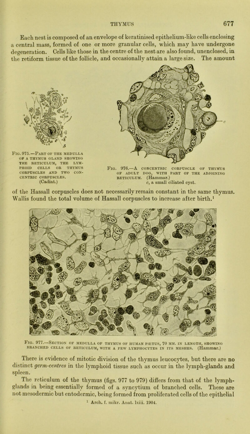 There is evidence of mitotic division of the thymus leucocytes, but there are no distinct germ-centres in the lymphoid tissue such as occur in the lymph-glands and spleen. The reticulum of the thymus (figs. 977 to 979) difiers from that of the lymph- glands in being essentially formed of a syncytium of branched cells. These are not mesodermicbut entodermic, being formed from proliferated cells of the epithelial ^ Arch. f. niikr. Amit. Ixiii. 1904. Each nest is composed of an envelope of keratinised epithelium-like cells enclosing a central mass, formed of one or more granular cells, which may have undergone degeneration. Cells like those in the centre of the nest are also found, unenclosed, in the retiform tissue of the follicle, and occasionally attain a large size. The amount of the Hassall corpuscles does not necessarily remain constant in the same thymus. Wallis found the total volume of Hassall corpuscles to increase after birth.* Fig. 977.—Section of medulla op thymus of human fcetus, 70 mm. in length, showing BRANCHED CELLS OF RETICULUM, WITH A FEW LYMPHOCYTES IN ITS MESHES. (Hammar.) cg. Fig. 975.—P.art of the medulla OF A THYMUS GLAND SHOWING the reticulum, THE LYM- PHOID CELLS OB THYMUS CORPUSCLES AND TWO CON- CENTRIC CORPUSCLES. (Cadiat.) Fig. 976.—A concentric corpuscle op thymus OP ADULT DOG, WITH PART OF THE ADJOINING RETICULUM. (Hammar.) c, a small ciliated cyst.