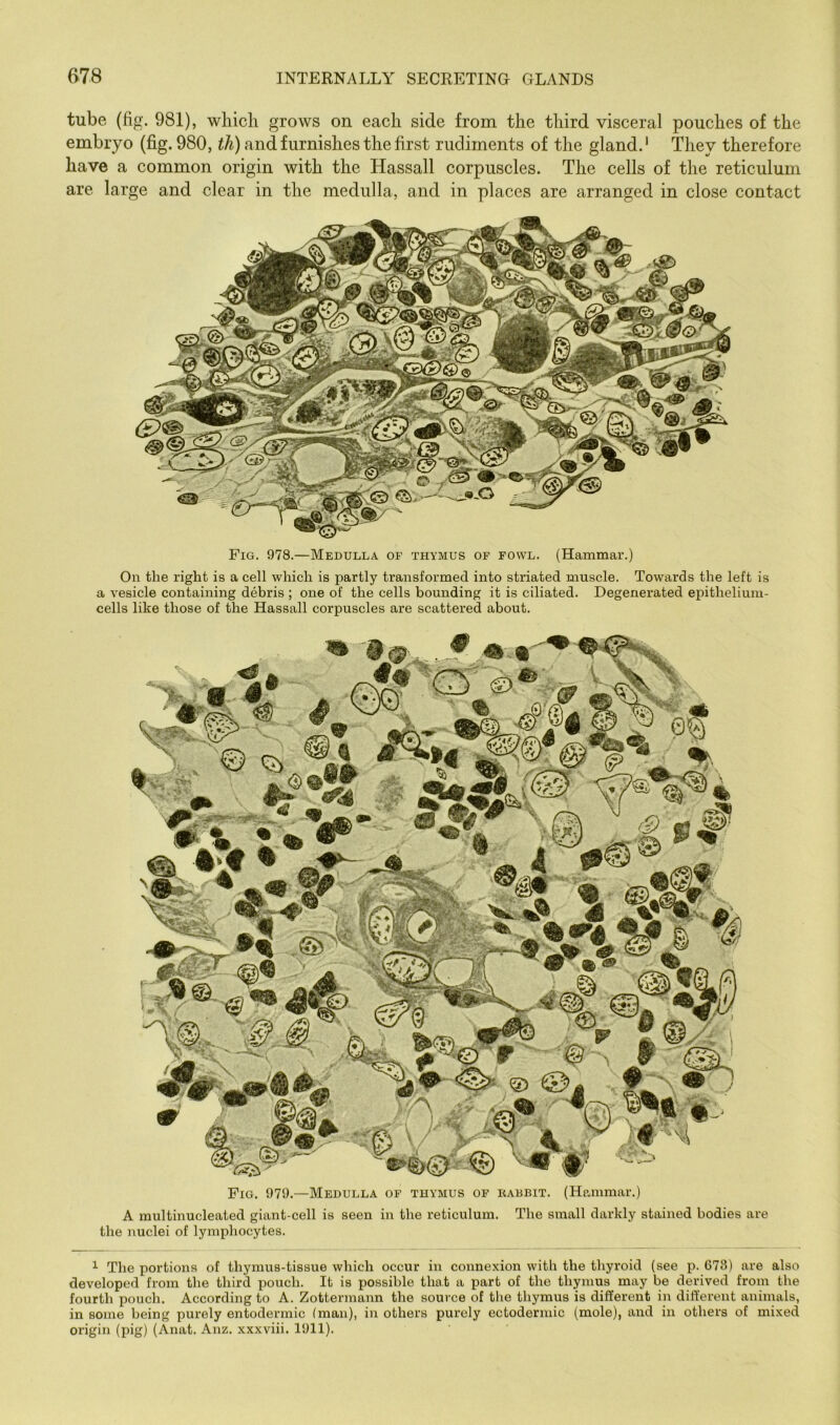 tube (fig. 981), which grows on each side from the third visceral pouches of the embryo (fig. 980, ih) and furnishes the first rudiments of the gland.' They therefore have a common origin with the Hassall corpuscles. The cells of the reticulum are large and clear in the medulla, and in places are arranged in close contact Fig. 979.—Medulla of thymus of kabbit. (Hammar.) A multinucleatecl giant-cell is seen in the reticulum. The small darkly stained bodies are the nuclei of lymphocytes. ^ The portions of thymus-tissue which occur in connexion with the thyroid (see p. 673) are also developed from the third pouch. It is possible that a part of the thymus may be derived from the fourth pouch. According to A. Zottermann the source of the thymus is different in dilTerent animals, in some being purely entodermic (man), in others purely ectodermic (mole), and in others of mixed origin (pig) (Anat. Anz. xxxviii. 1911). Fig. 978.—Medulla of thymus of fowl. (Hammar.) On the right is a cell which is partly transformed into striated muscle. Towards the left is a vesicle containing debris ; one of the cells bounding it is ciliated. Degenerated epithelium- cells like those of the Hassall corpuscles are scattered about.