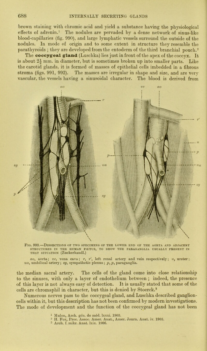 brown staining with chromic acid and yield a substance having the physiological effects of adrenin.' The nodules are pervaded by a dense network of sinus-like blood-capillaries (fig. 990), and large lymphatic vessels surround the outside of the nodules. In mode of origin and to some extent in structure they resemble the parathyroids ; they are developed from the entoderm of the third branchial pouch.^ The coccyg-eal g*land (Luschka) lies just in front of the apex of the coccyx. It is about 2J mm. in diameter, but is sometimes broken up into smaller parts. Like the carotid glands, it is formed of masses of epithelial cells imbedded in a fibrous stroma (figs. 991, 992). The masses are irregular in shape and size, and are very vascular, the vessels having a sinusoidal character. The blood is derived from Fig. 993.—Dissectioks of two specimens of the lower end of the aorta and adjacent STRUCTURES IN THE HUMAN FOETUS, TO SHOW THE PARAGANGLIA USUALLY PRESENT IN THAT SITUATION (Zuckerkandl.) ao, aorta; vc, vena cava; ?*, r', left renal artery and vein respectively; u, ureter; ua, umbilical artery; sy, sympathetic plexus ; j)araganglia. the median sacral artery. The cells of the gland come into close relationship to the sinuses, with only a layer of endothelium between ; indeed, the presence of this layer is not always easy of detection. It is usually stated that some of the cells are chromaphil in character, but this is denied by Stoerck.'^ Numerous nerves pass to the coccygeal gland, and Luschka described ganglion- cells within it, but this description has not been confirmed by modern investigations. The mode of development and the function of the coccygeal gland has not been ^ Muloii, Arch. g(hi. de m4d. Ixxxi. 1903. - H. Fox, Proc. Assoc. Amer. Anat., Amer. Journ. Anat. iv. 1905. ^ Arch. f. mikr. Anat. Ixix. 1906. ao VC !