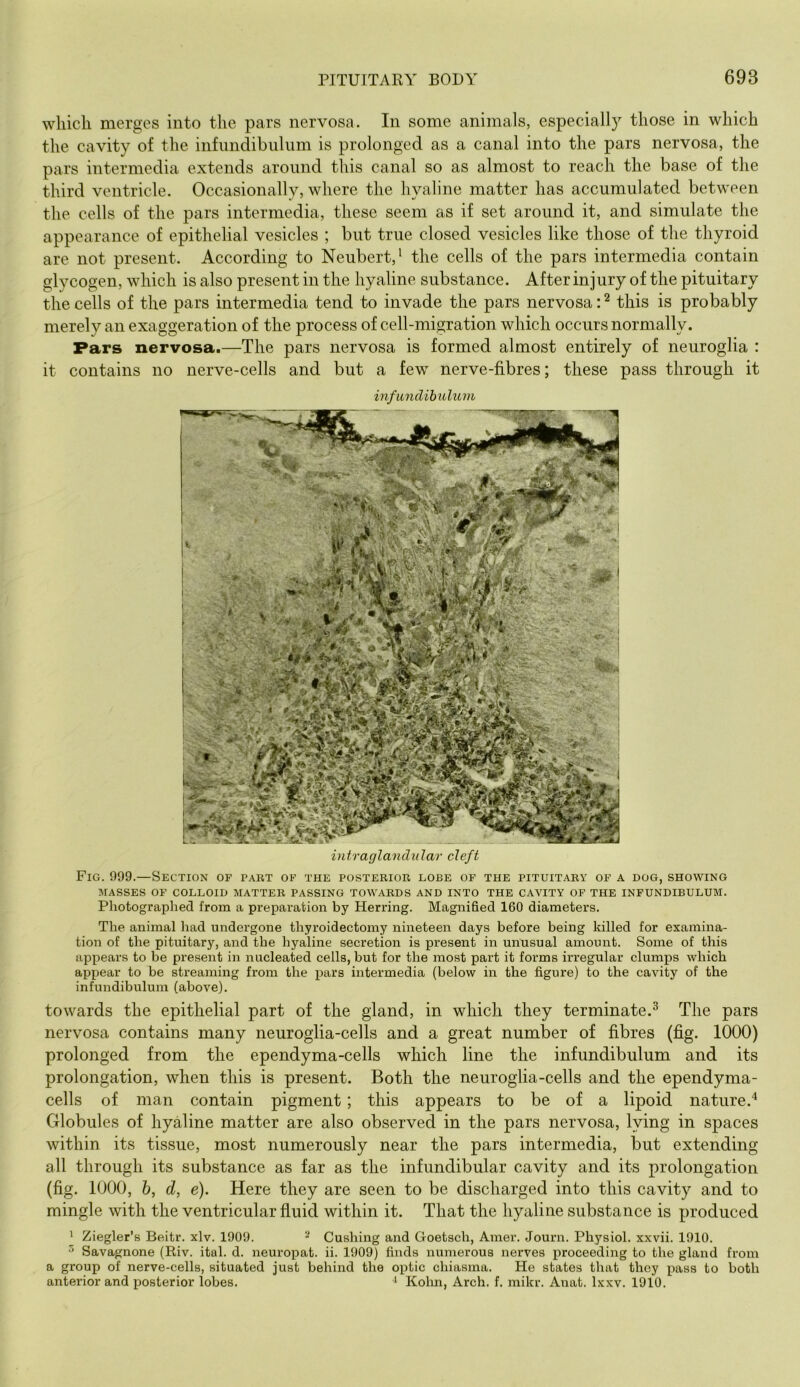 which merges into the pars nervosa. In some animals, especially those in which the cavity of the infiindibiilum is prolonged as a canal into the pars nervosa, the pars intermedia extends around this canal so as almost to reach the base of the third ventricle. Occasionally, where the hyaline matter has accumulated between the cells of the pars intermedia, these seem as if set around it, and simulate the appearance of epithelial vesicles ; but true closed vesicles like those of the thyroid are not present. According to Neubert,^ the cells of the pars intermedia contain glycogen, which is also present in the hyaline substance. After injury of the pituitary the cells of the pars intermedia tend to invade the pars nervosa: ^ this is probably merely an exaggeration of the process of cell-migration which occurs normally. Pars nervosa.—The pars nervosa is formed almost entirely of neuroglia : it contains no nerve-cells and but a few nerve-fibres; these pass through it infimdibulum intraglandular cleft Fig. 999.—Section of part of the posterior lobe of the pituitary of a dog, showing MASSES OF COLLOID MATTER PASSING TOWARDS AND INTO THE CAVITY OF THE INFUNDIBULUM. Photographed from a preparation by Herring. Magnified 160 diameters. The animal had undergone thyroidectomy nineteen days before being killed for examina- tion of the pituitary, and the hyaline secretion is present in unusual amount. Some of this appears to be present in nucleated cells, but for the most part it forms irregular clumjis which appear to be streaming from the pars intermedia (below in the figure) to the cavity of the infundibulum (above). towards the epithelial part of the gland, in which they terminate.^ The pars nervosa contains many neuroglia-cells and a great number of fibres (fig. 1000) prolonged from the ependyma-cells which line the infundibulum and its prolongation, when this is present. Both the neuroglia-cells and the ependyma- cells of man contain pigment; this appears to be of a lipoid nature.'* Globules of hyaline matter are also observed in the pars nervosa, lying in spaces within its tissue, most numerously near the pars intermedia, but extending all through its substance as far as the infundibular cavity and its prolongation (fig. 1000, 6, d, e). Here they are seen to be discharged into this cavity and to mingle with the ventricular fluid within it. That the hyaline substance is produced ’ Ziegler’s Beitr. xlv. 1909. ^ Cushing and Goetsch, Amer. Journ. Physiol, xxvii. 1910. ^ Savagnone (Riv. ital. d. neuropat. ii. 1909) finds numerous nerves proceeding to the gland from a group of nerve-cells, situated just behind the optic chiasma. He states that they pass to both anterior and posterior lobes. i Kolm, Arch. f. mikr. Anat. Ixxv. 1910.