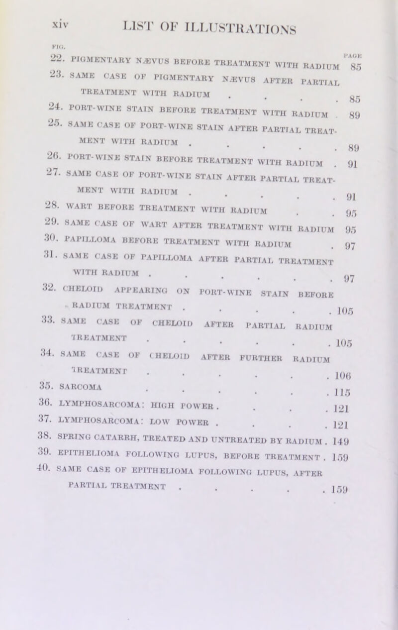 no 22. 23 24. 25. 2(5. 27. 28. 29. 30. 31. 32. 33. 34. 35. 36. 37. 38. 39. 40. PIGMENTARY N.HVUS BEFORE TREATMENT WITH RADIUM . SAME CASE OF PIGMENTARY NJ2VUS AFTER PARTIAL TREATMENT WITH RADIUM . PORT-WINE STAIN BEFORE TREATMENT WITH RADIUM SAME CASE OF PORT-WINE STAIN AFTER PARTIAL TREAT MENT WITH RADIUM . PORT-WINE STAIN BEFORE TREATMENT WITH RADIUM SAME CASE OF PORT-WINE STAIN AFTER PARTIAL TREAT MENT WITH RADIUM . WART BEFORE TREATMENT WITH RADIUM SAME CASE OF WART AFTER TREATMENT WITH RADIUM PAPILLOMA BEFORE TREATMENT WITH RADIUM SAME CASE OF PAPILLOMA AFTER PARTIAL TREATMENT WITH RADIUM . CHELOID APPEARING ON PORT-WINE STAIN BEFORE RADIUM TREATMENT . SAME CASE OF CHELOID AFTER PARTIAL RADIUM 'IREATMENT SAME CASE OF CHELOID AFTER FURTHER RADIUM TREATMENT SARCOMA * * lymphosarcoma: high fow'er . lymphosarcoma: low power . SPRING CATARRH, TREATED AND UNTREATED BY RADIUM . EPITHELIOMA FOLLOWING LUPUS, BEFORE TREATMENT . SAME CASE OF EPITHELIOMA FOLLOWING LUPUS. AFTER PARTIAL TREATMENT . I'AOK 85 85 89 89 91 91 95 95 97 97 105 105 106 115 121 121 149 159 159